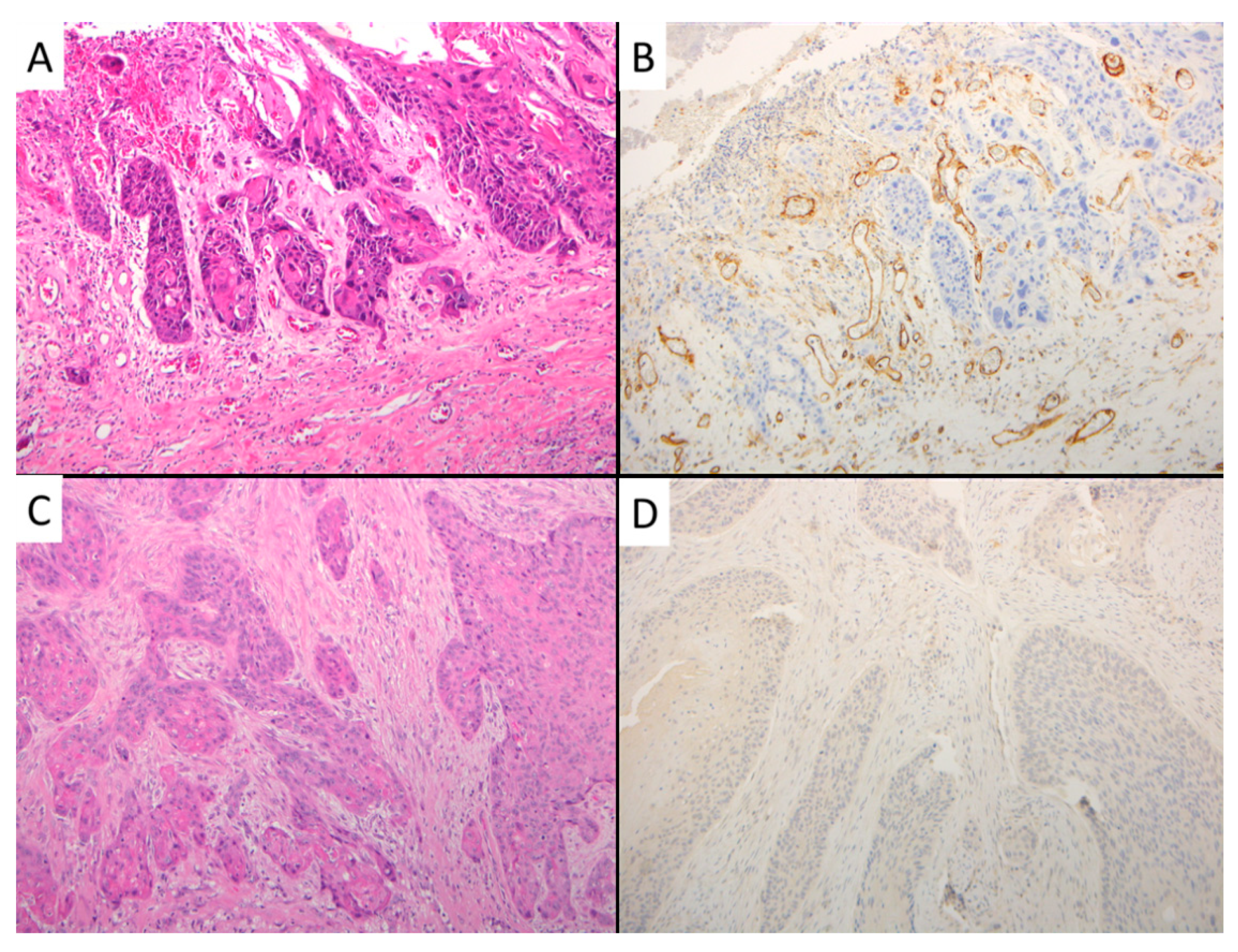 Cancers 13 03339 g002