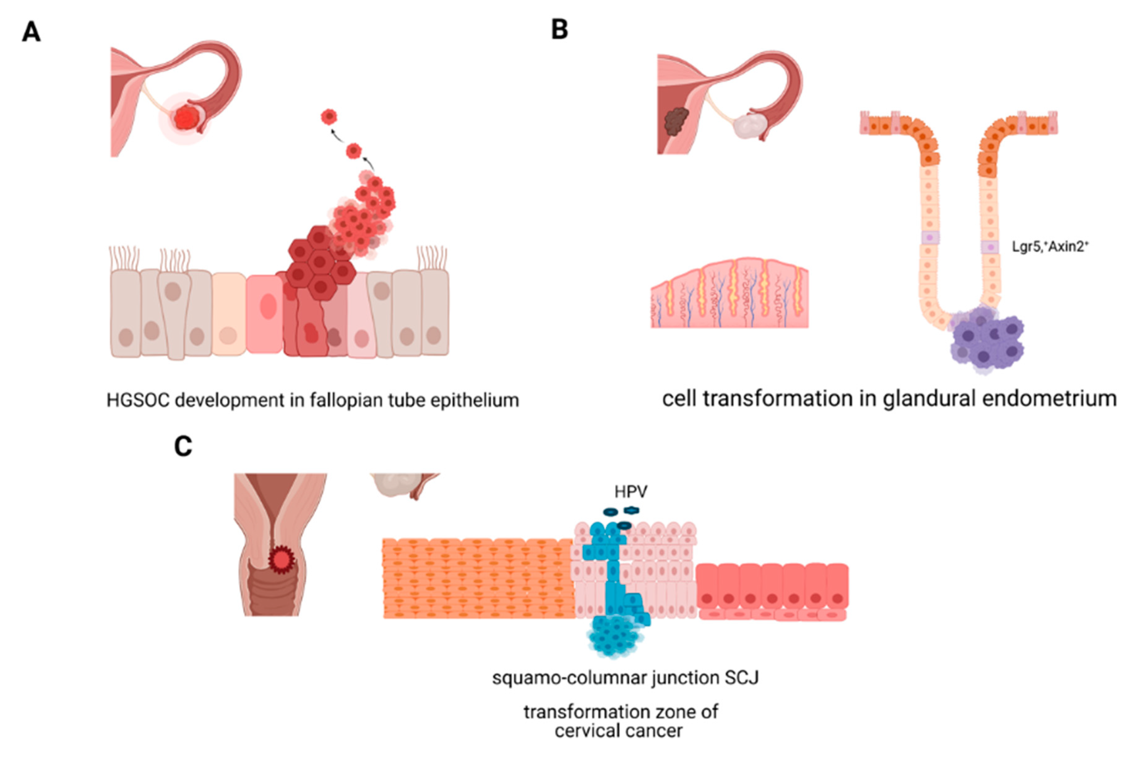 Cancers Free Full Text Changes In Stem Cell Regulation And Epithelial Organisation During Carcinogenesis And Disease Progression In Gynaecological Malignancies Html