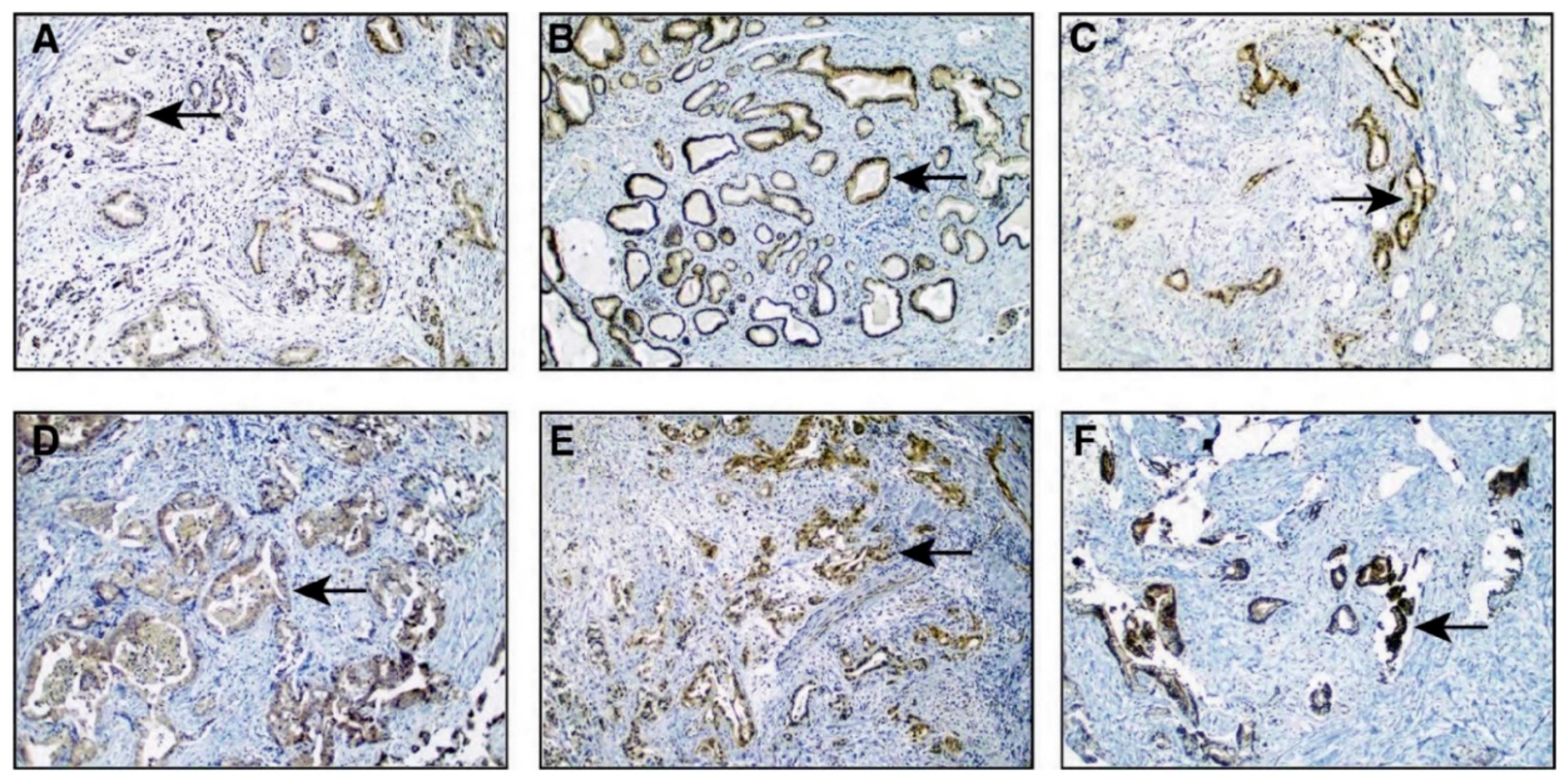 Cancers 13 03404 g007 550