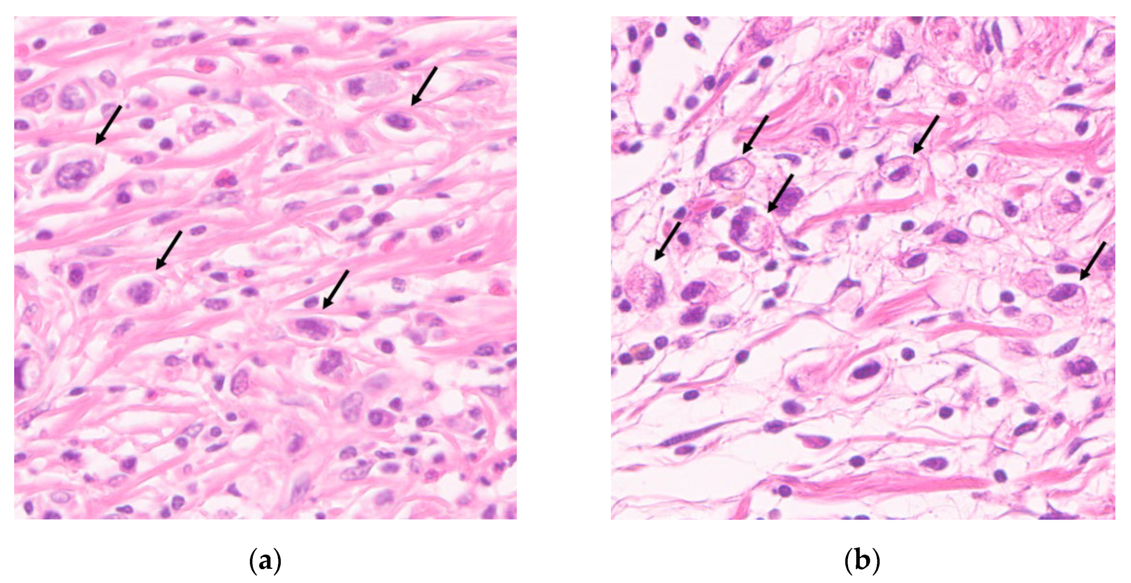 Cancers 13 03405 g001