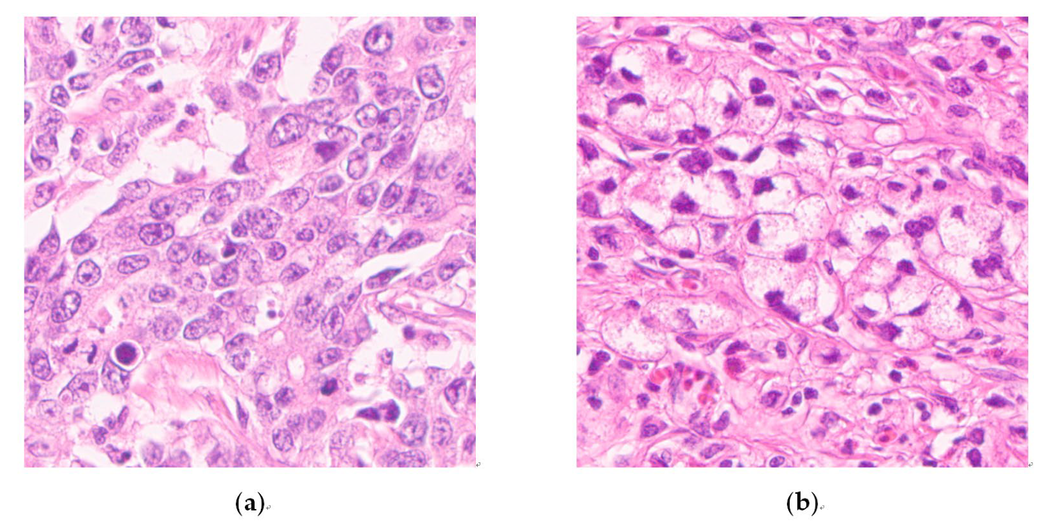 Cancers 13 03405 g002