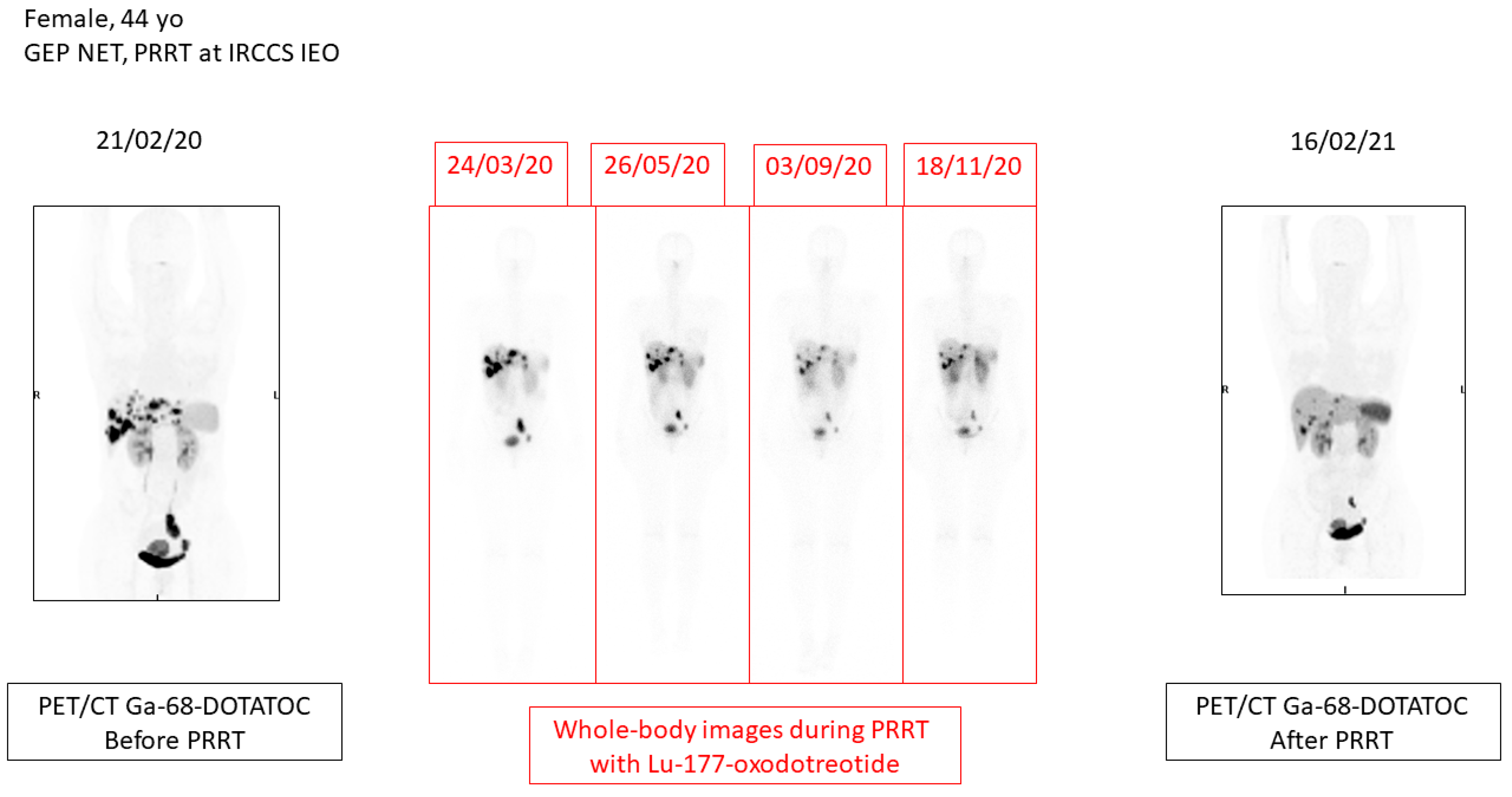 Cancers 13 03474 g001 550