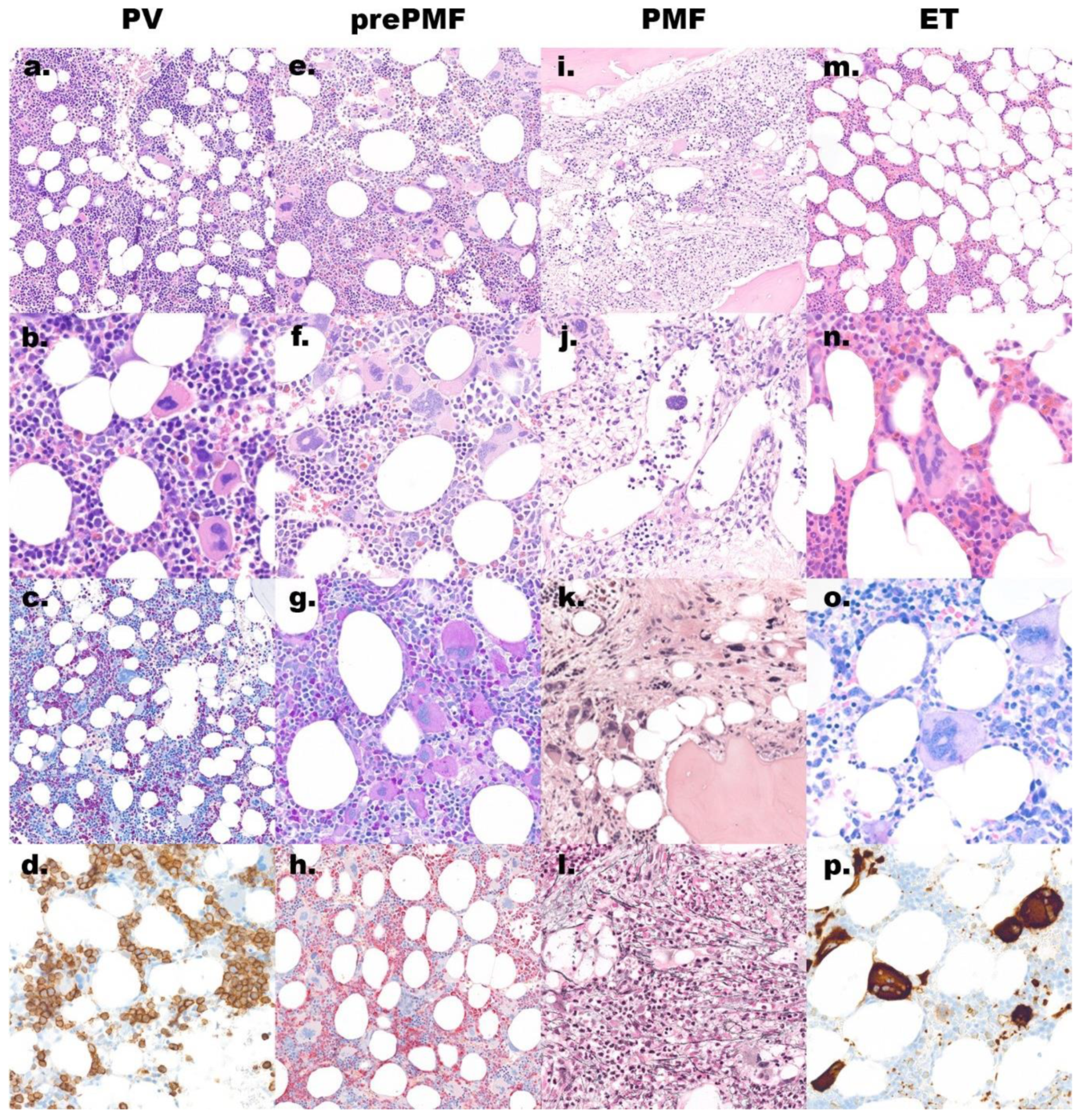 Cancers 13 03528 g001 Cancers 13 03528 g001