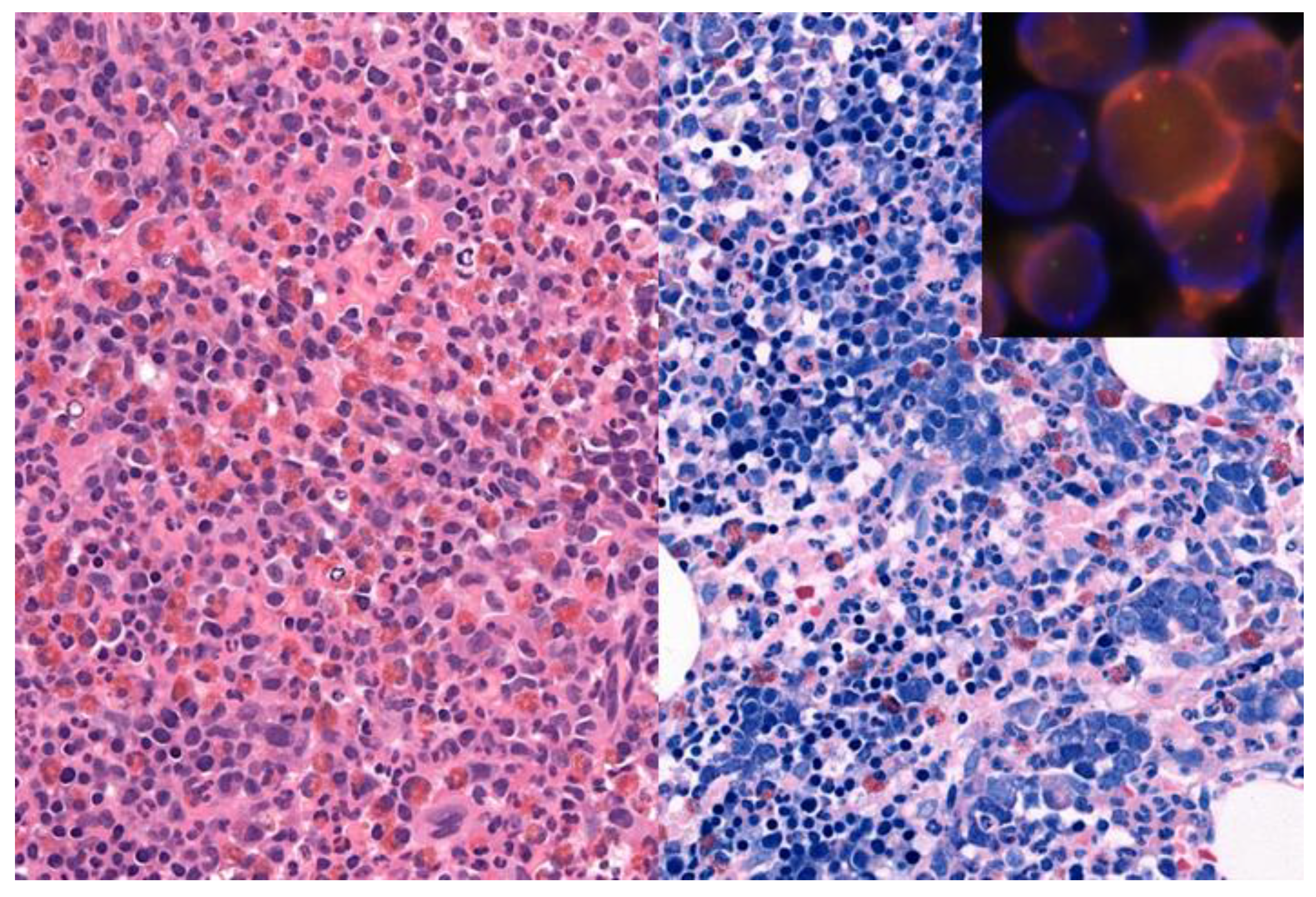 Cancers 13 03528 g002 Cancers 13 03528 g002