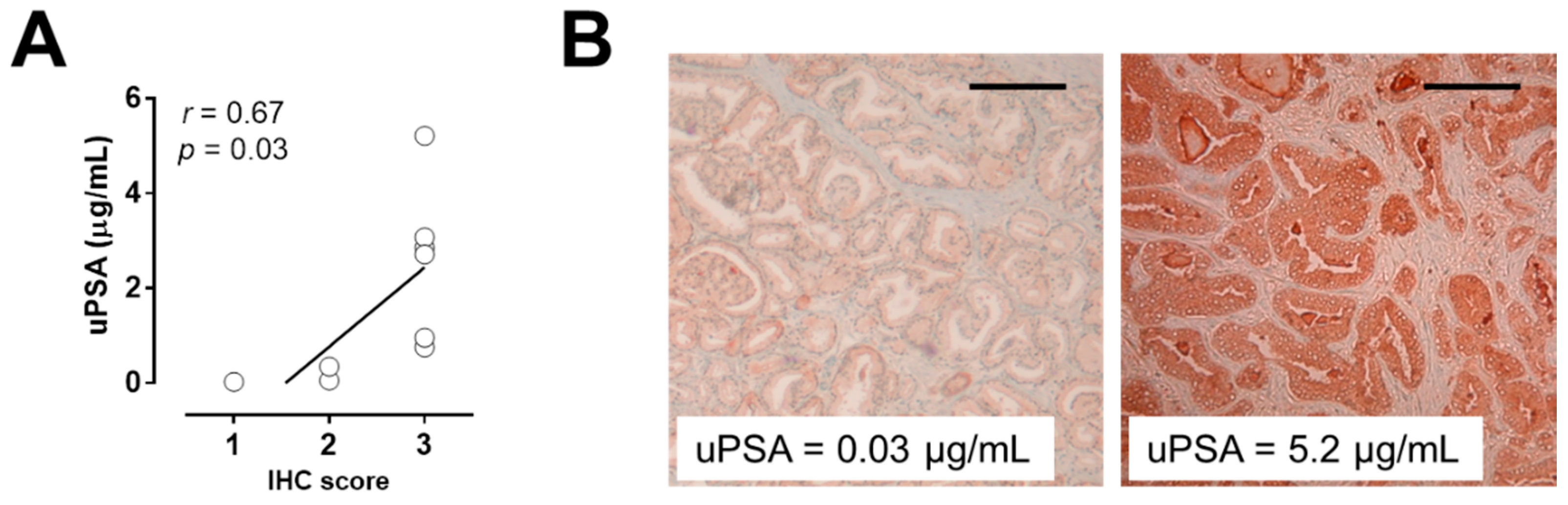 Changes of protein expression in prostate cancer having lost its androgen sensitivity.
