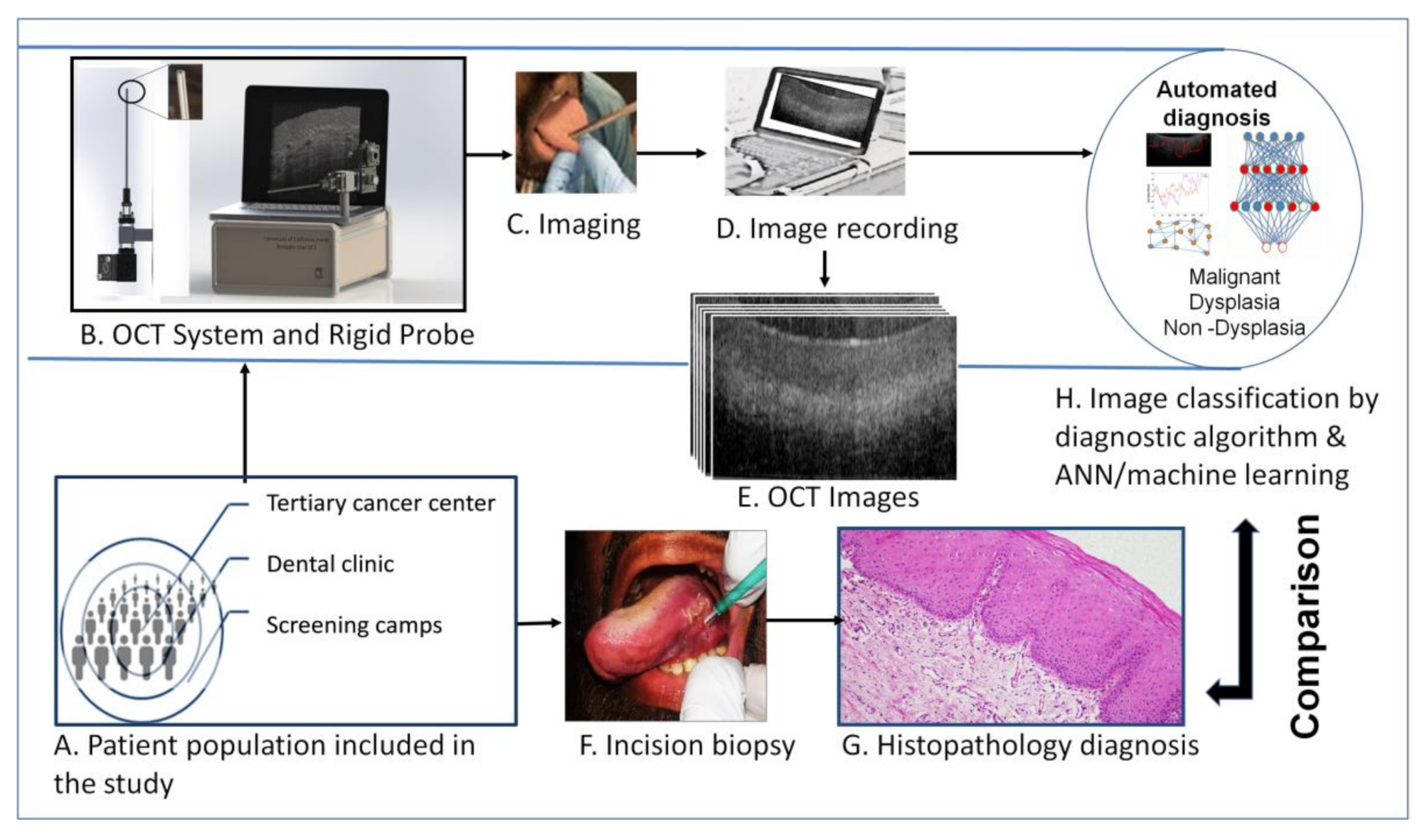 Optical Coherence Tomography Machine