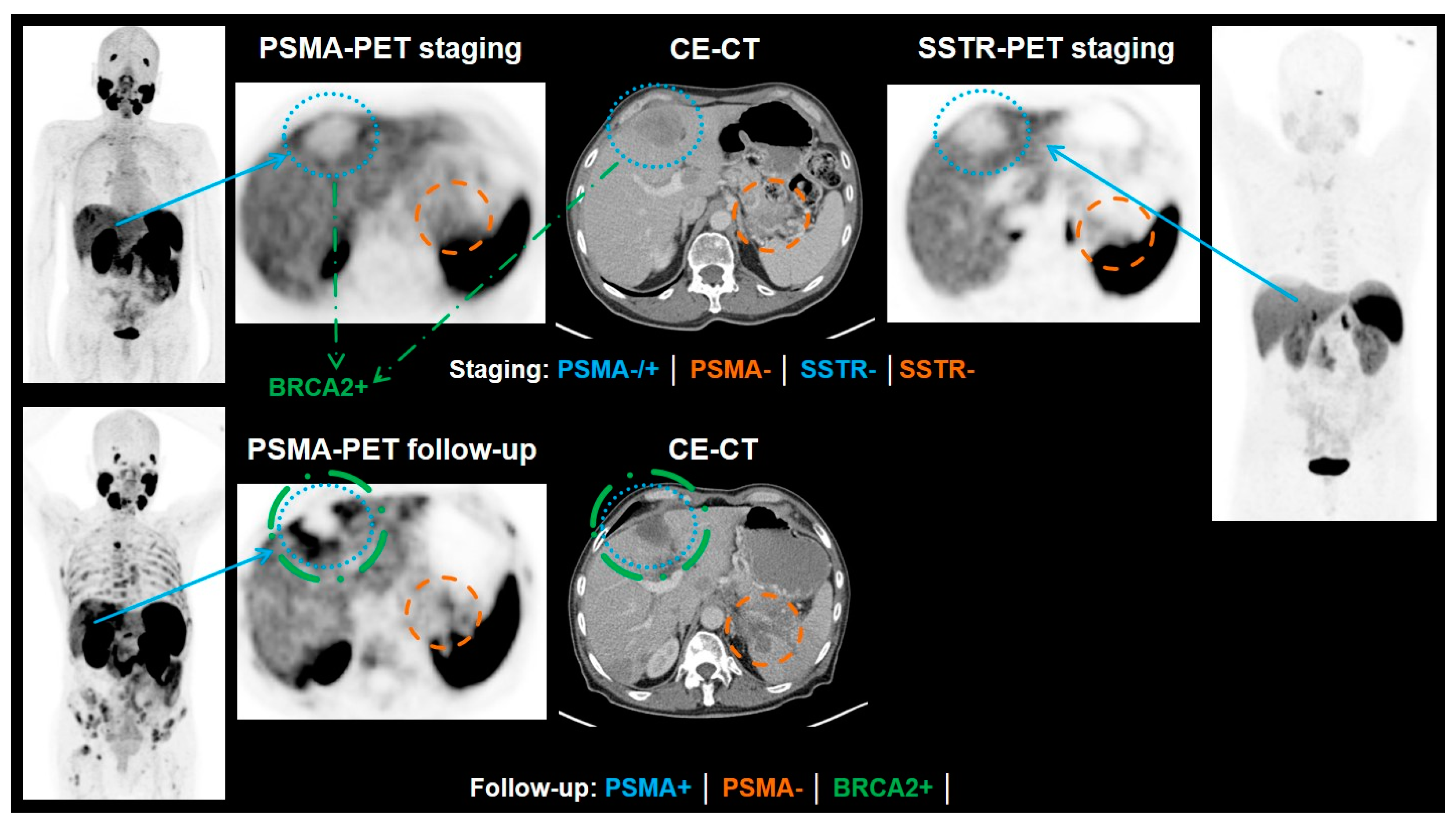 Cancers 13 03607 g005