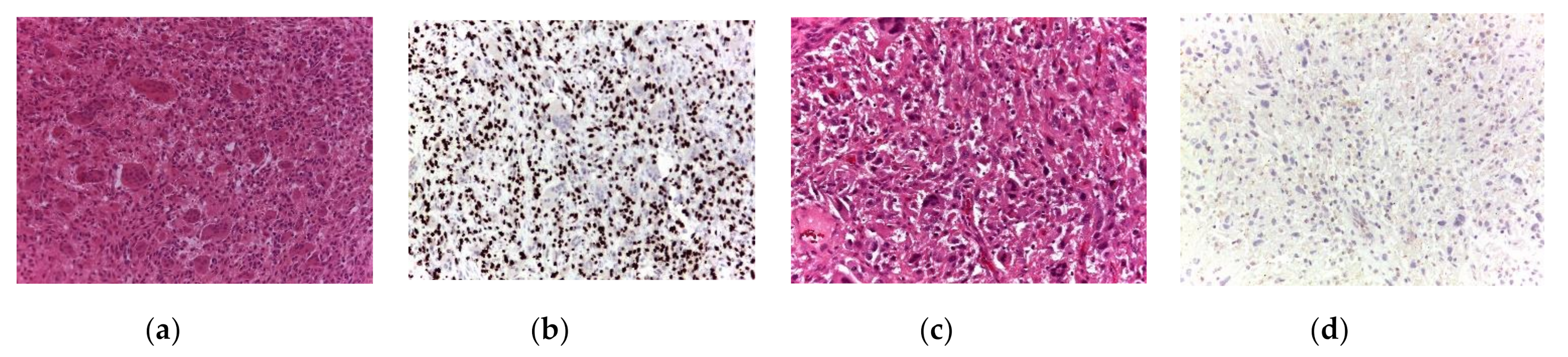 Cancers 13 03644 g003