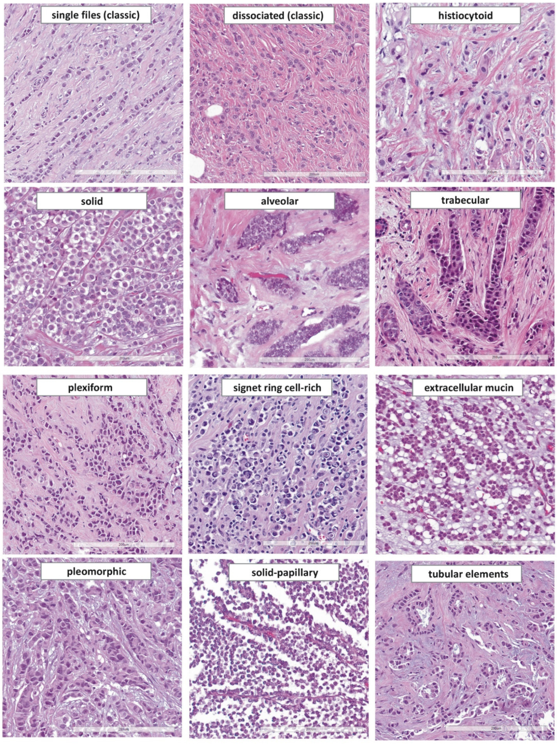 Cancers 13 03695 g004