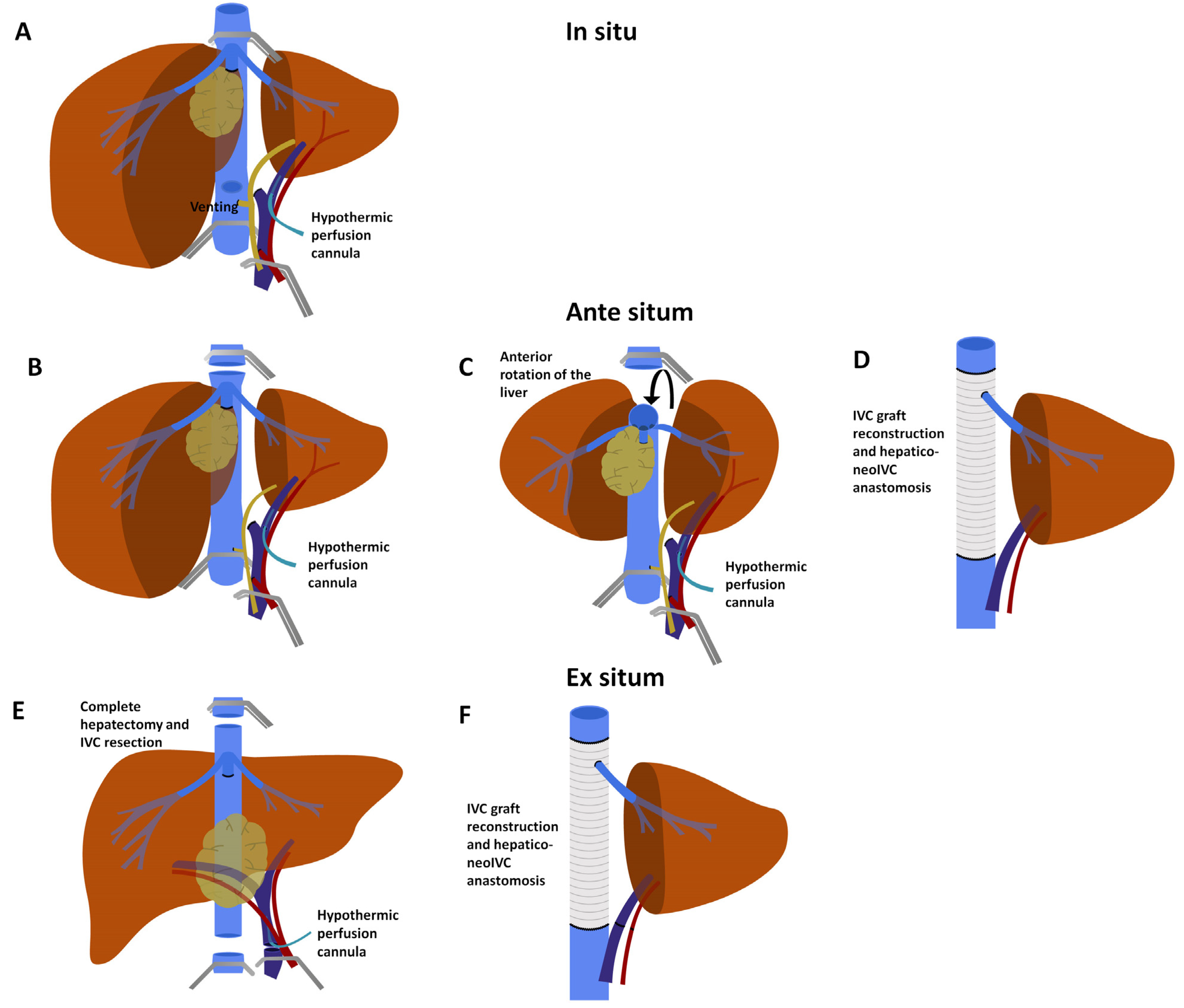 Cancers 13 03735 g003