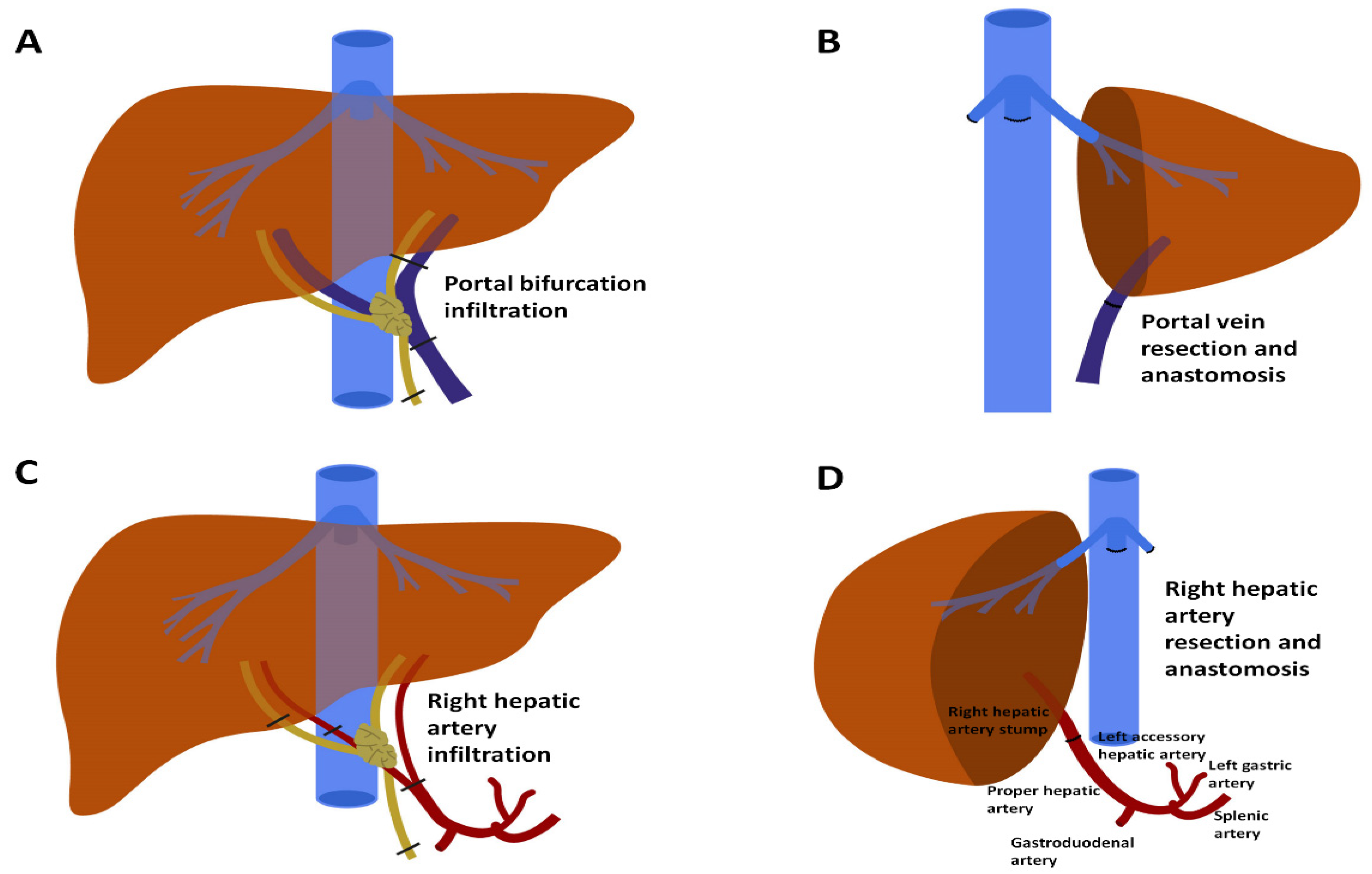 Cancers 13 03735 g004