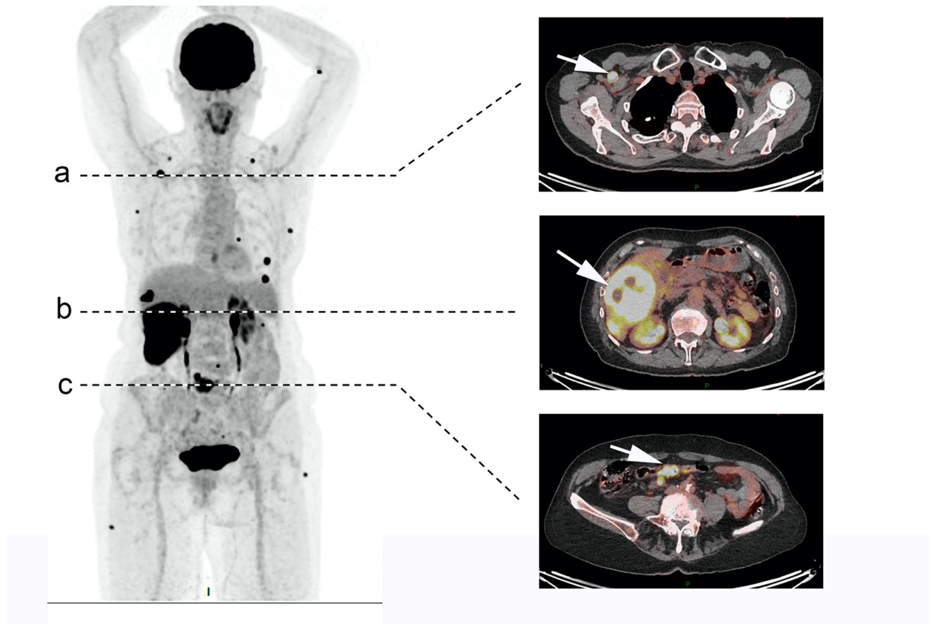 Cancers 13 03766 g001