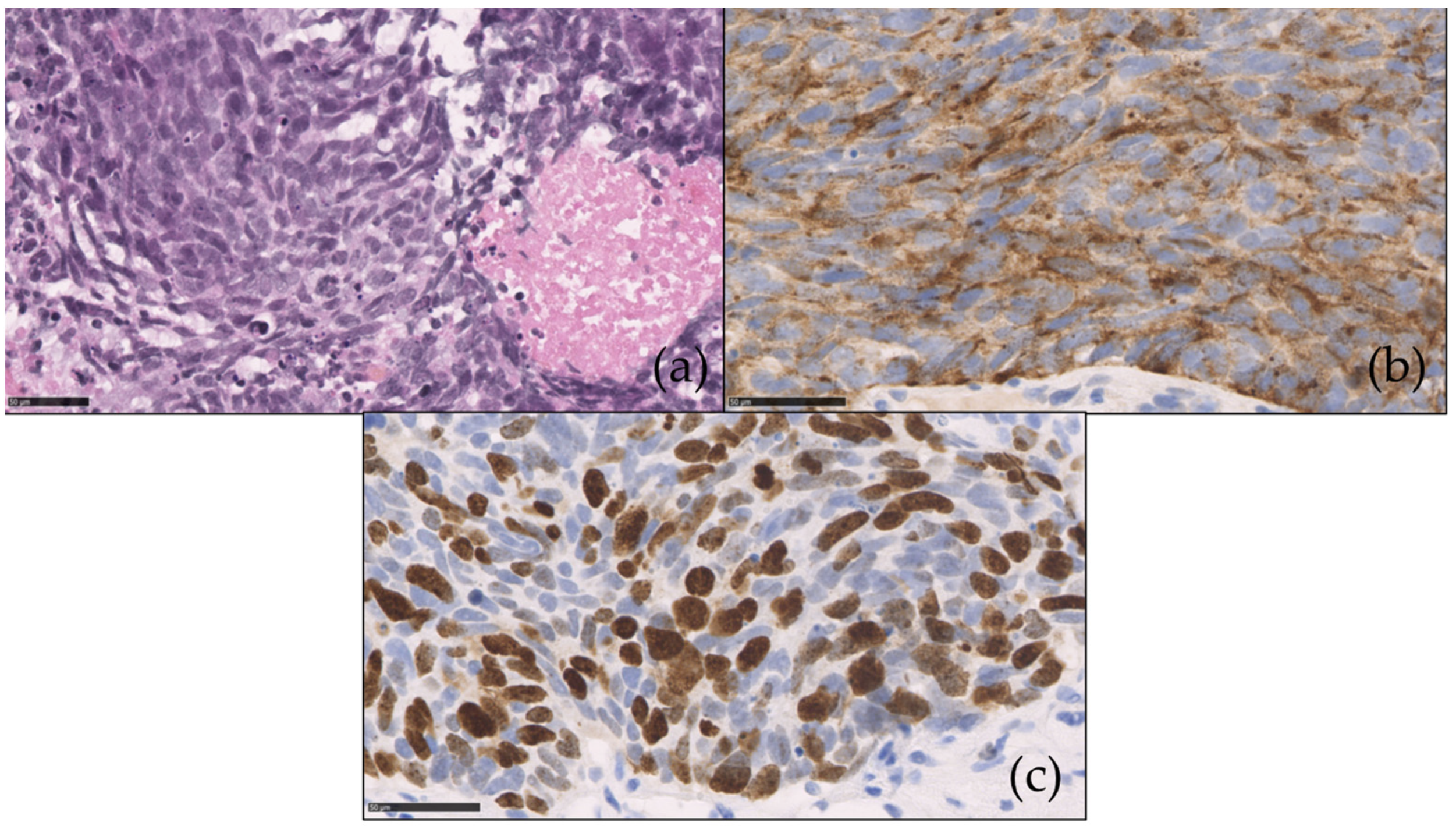 Cancers 13 03766 g002