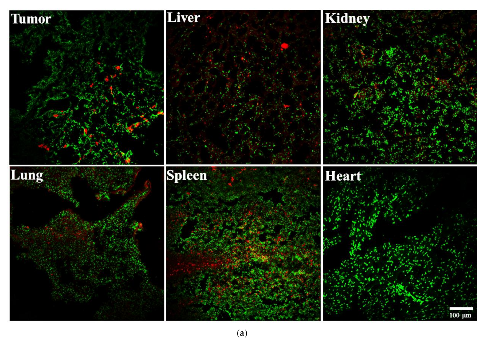 Cancers 13 03816 g005a 550
