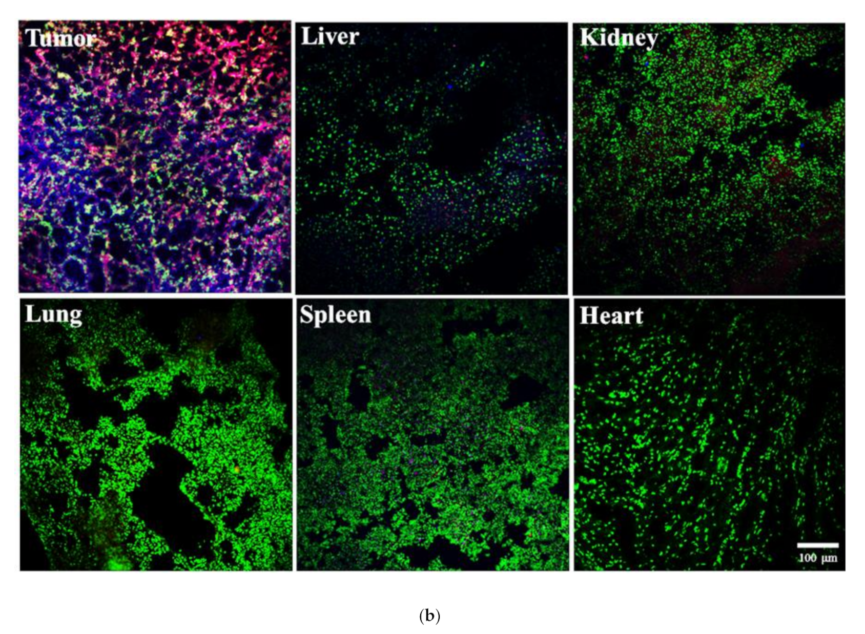 Cancers 13 03816 g005b 550