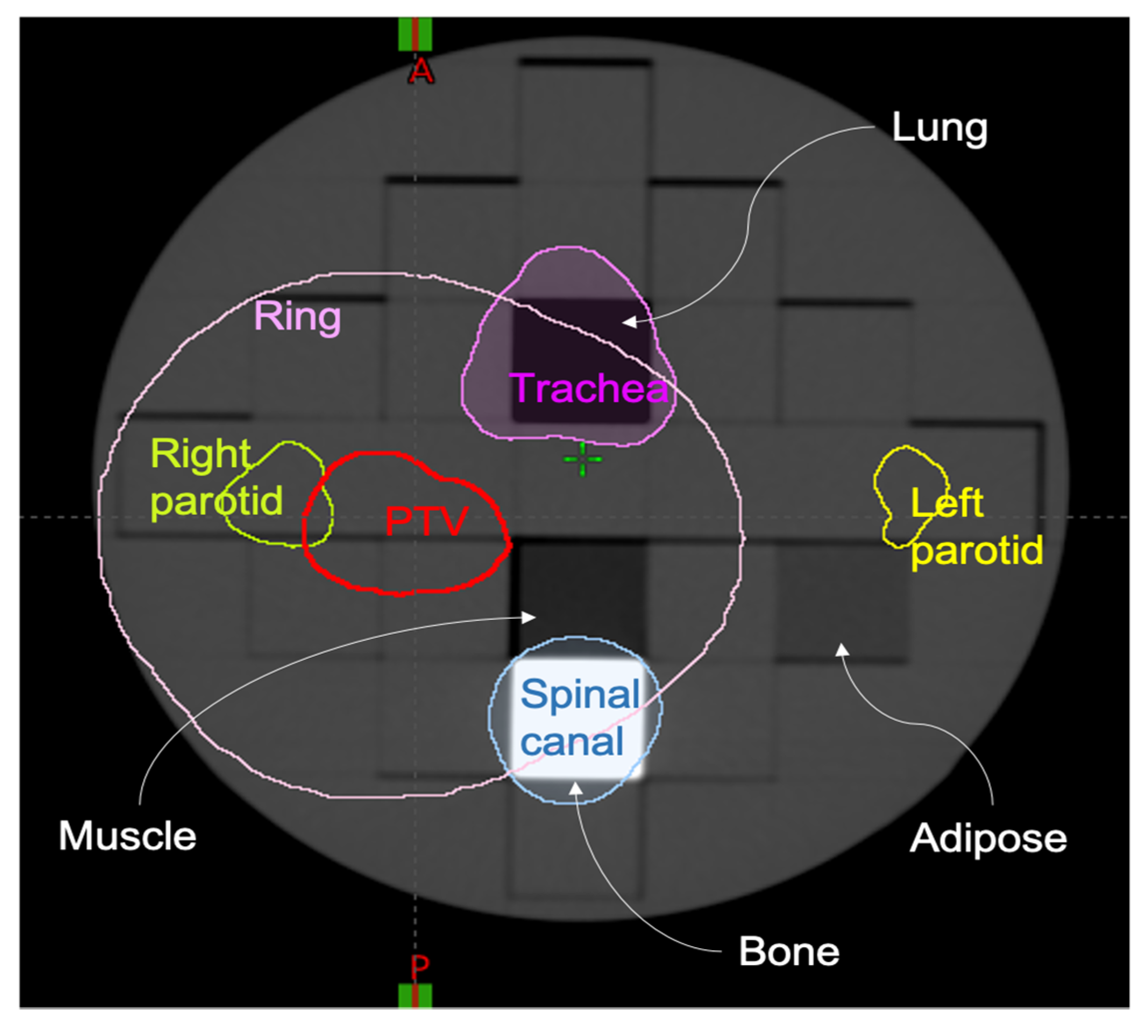 Cancers 13 03835 g001 550