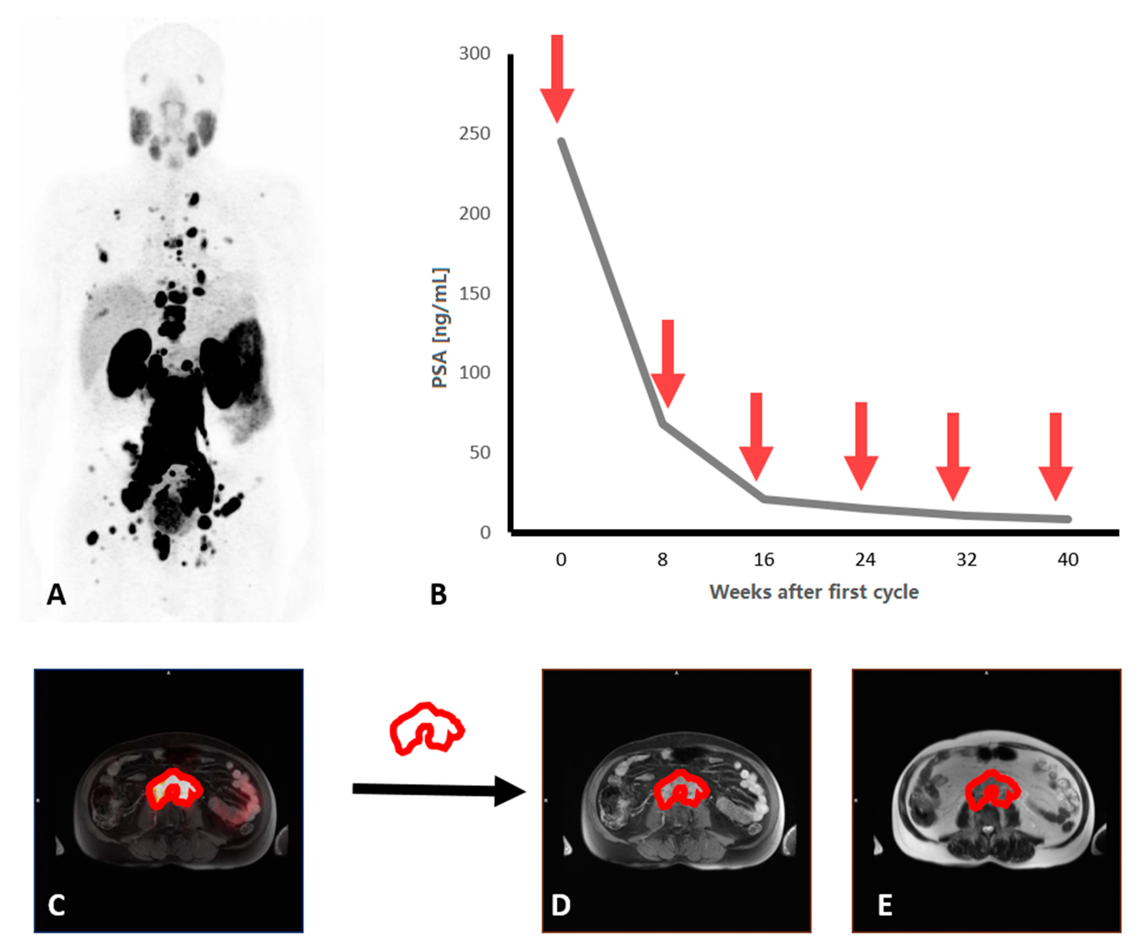 Cancers 13 03849 g001