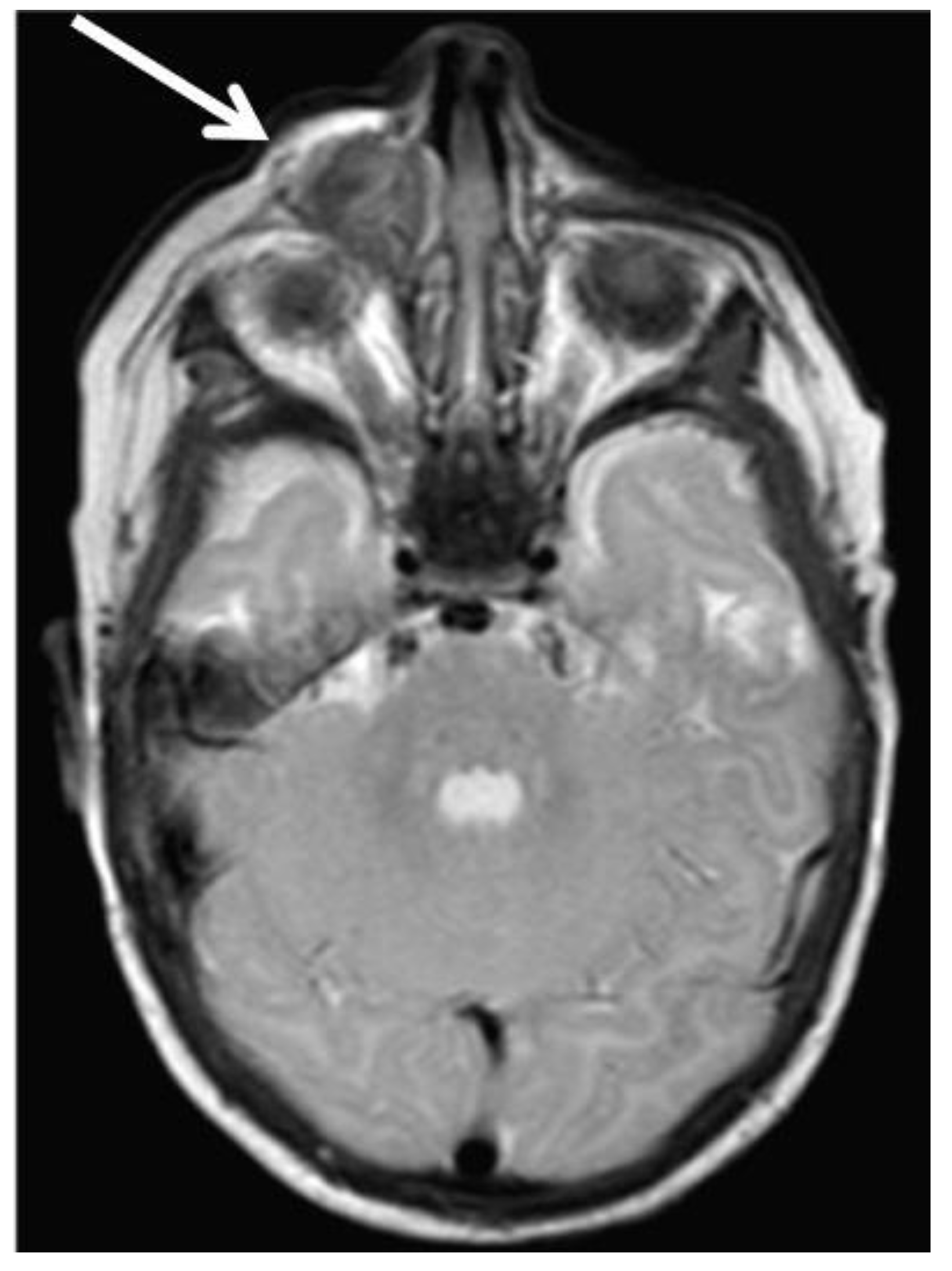 Cancers 13 03872 g002