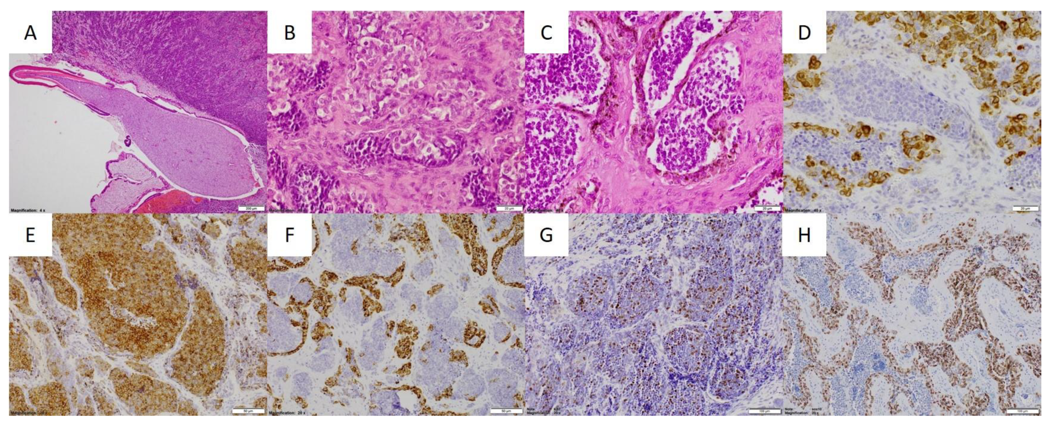 Cancers 13 03872 g003