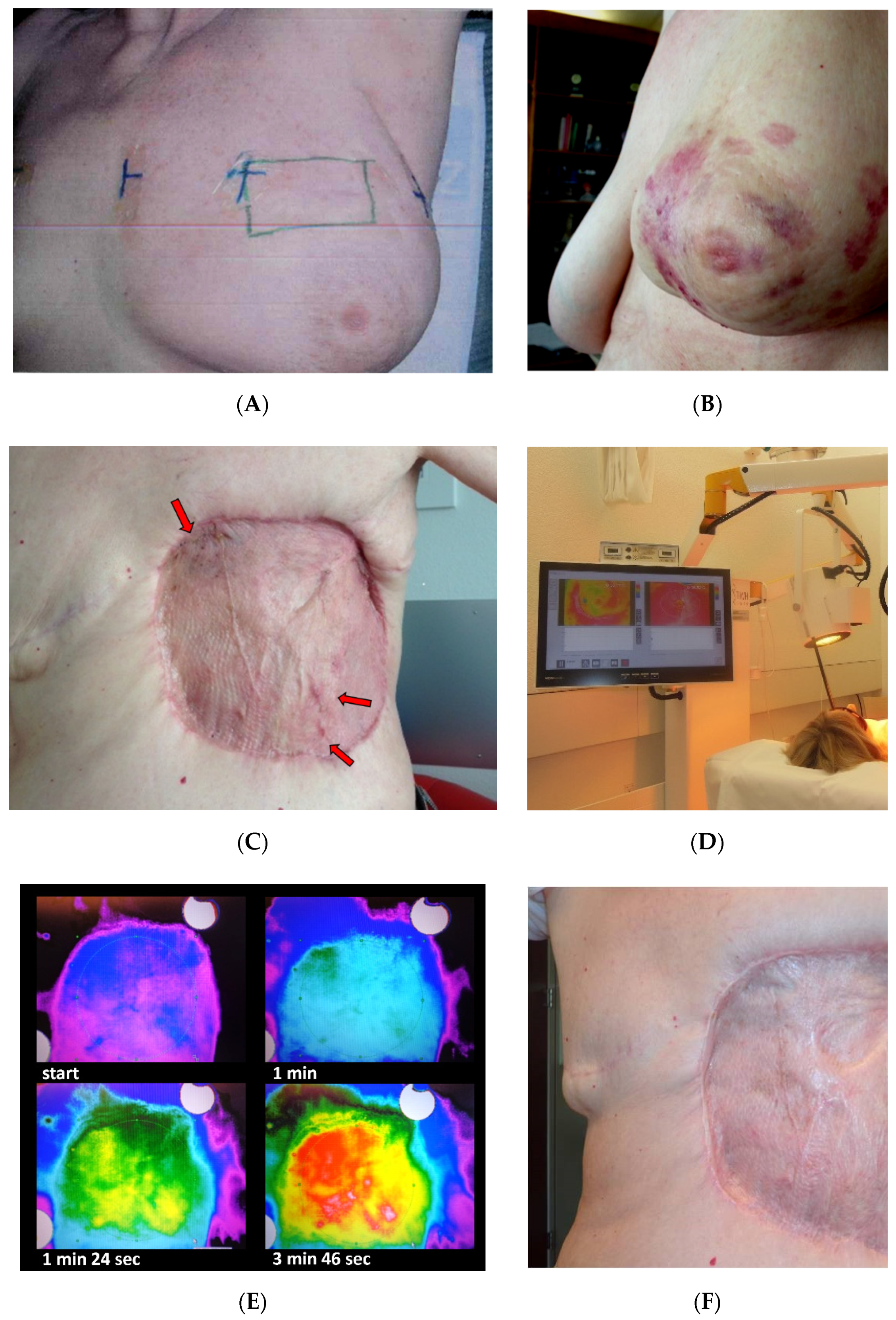 Cancers 13 03911 g002 550