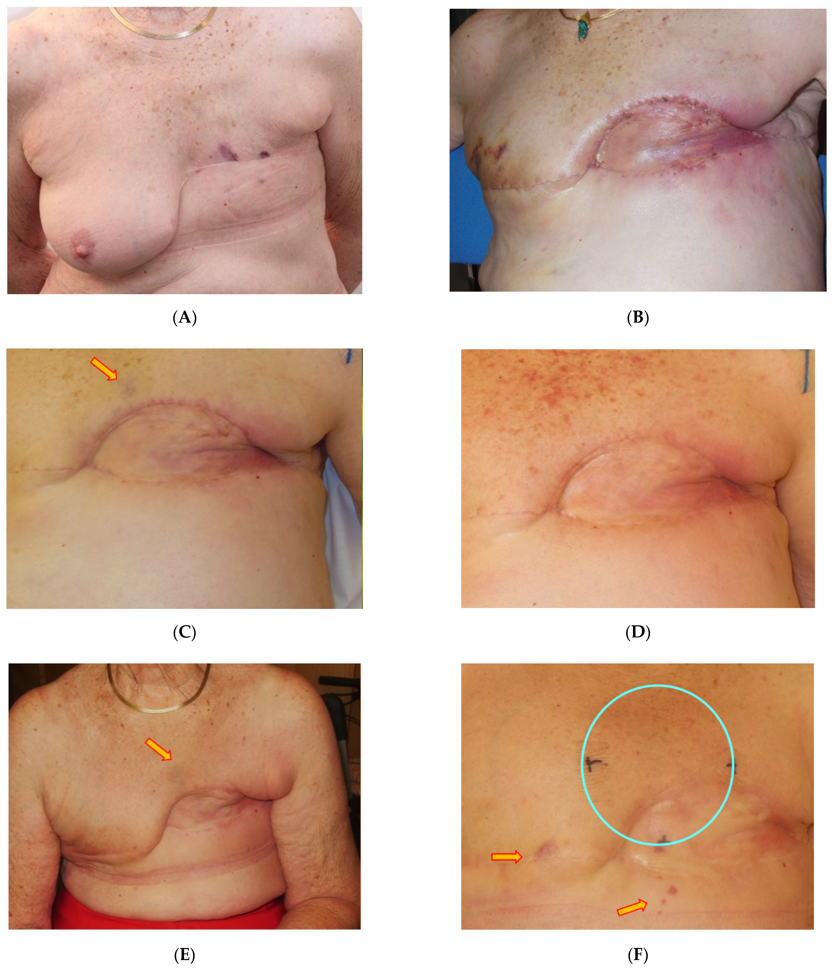 Cancers 13 03911 g004a 550