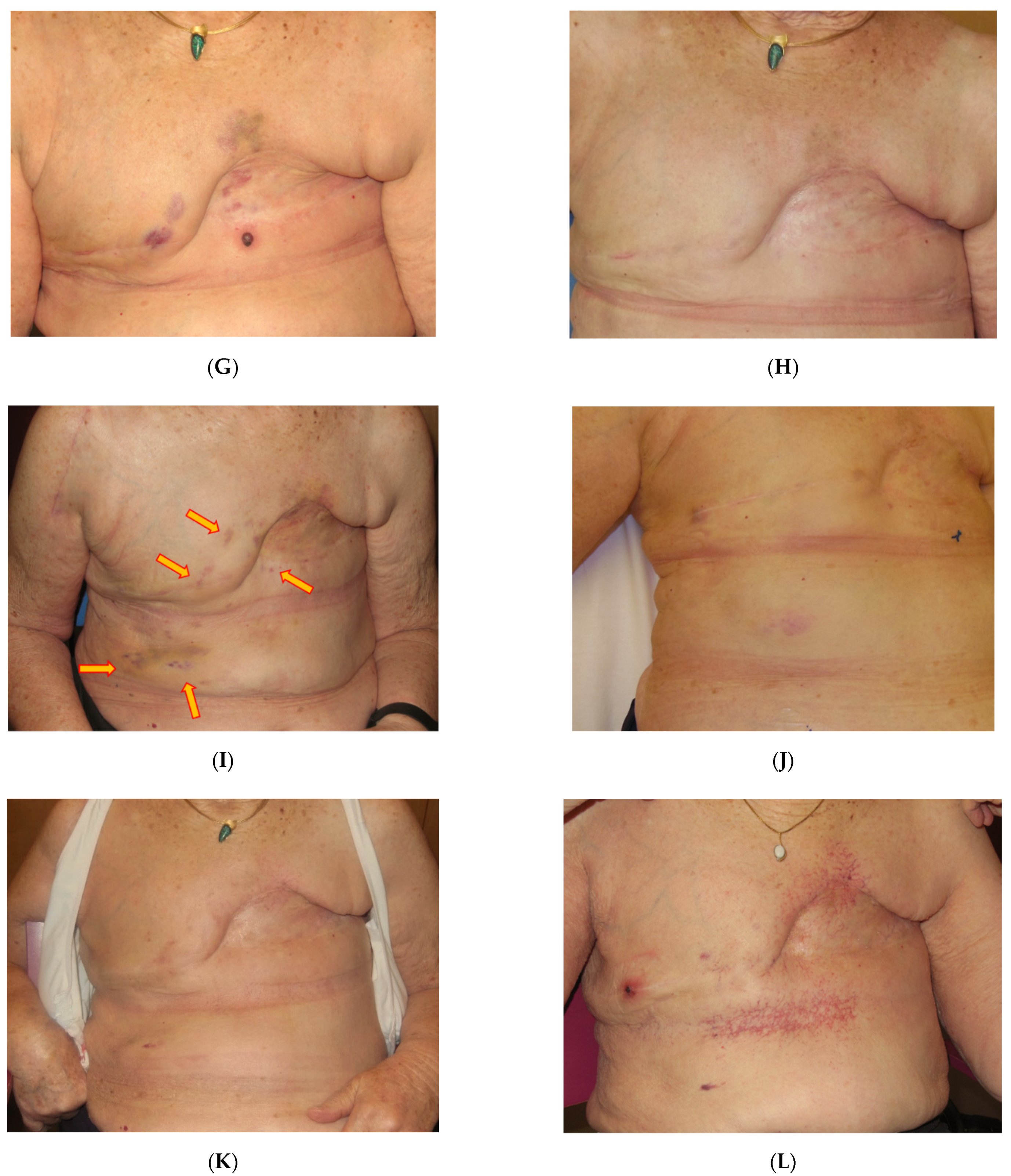 Cancers 13 03911 g004b 550