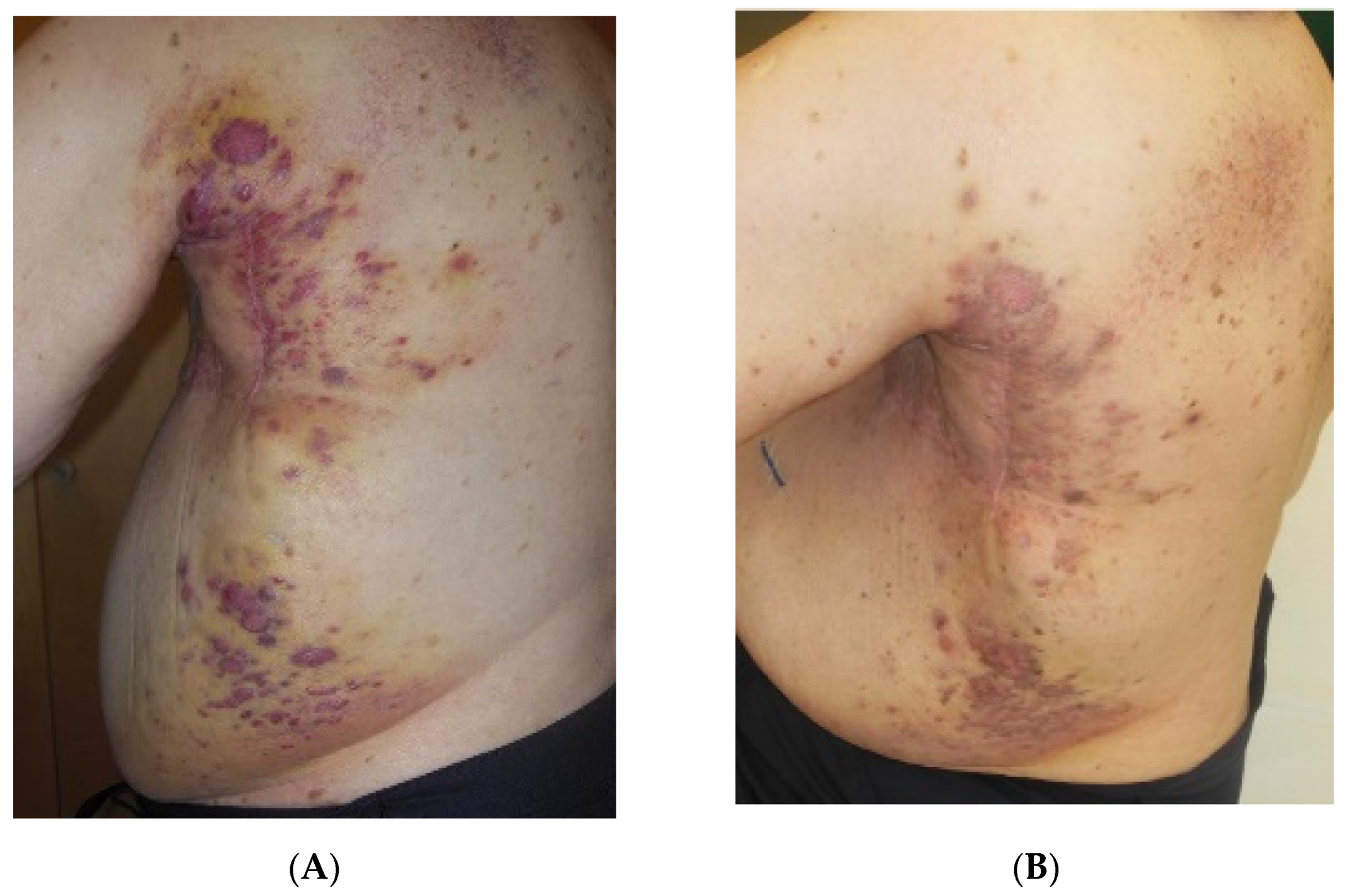 Cancers 13 03911 g005 550