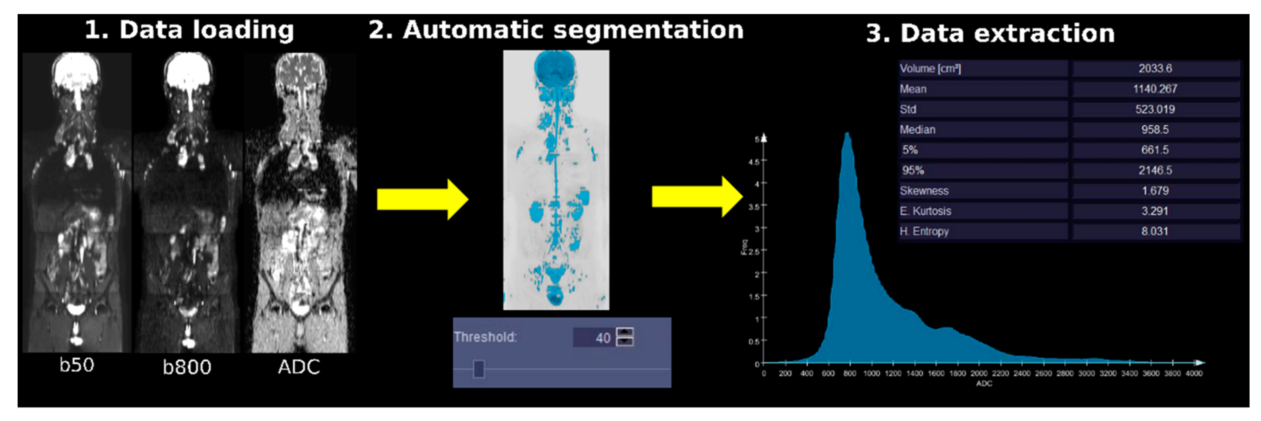 Cancers 13 03952 g002 Cancers 13 03952 g002