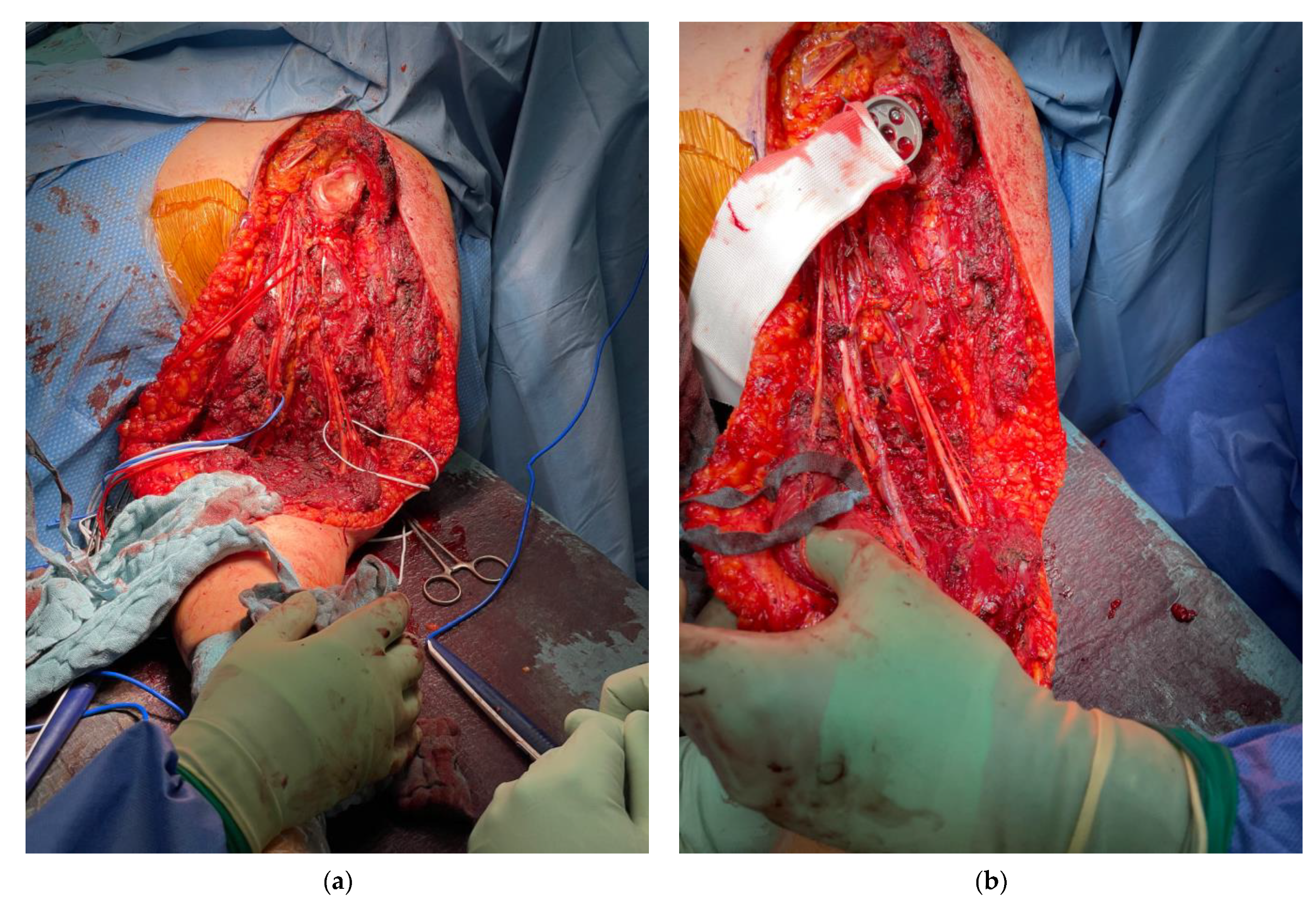 Cancers 13 03971 g003a 550