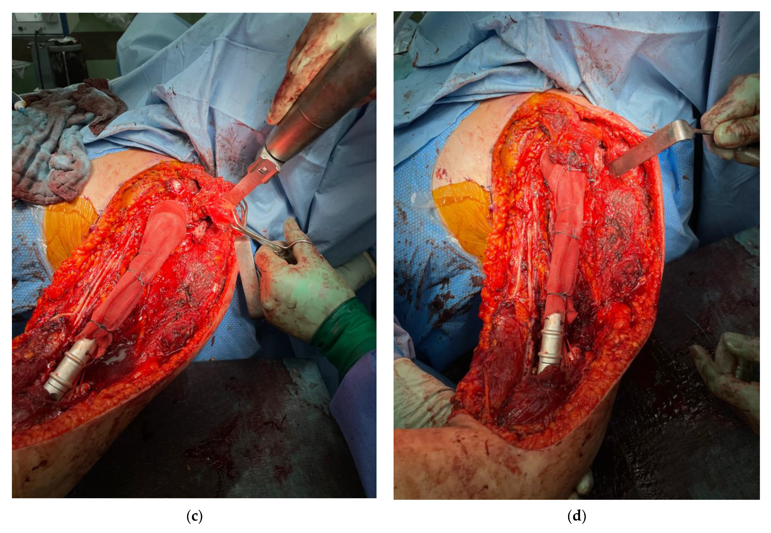 Cancers 13 03971 g003b 550