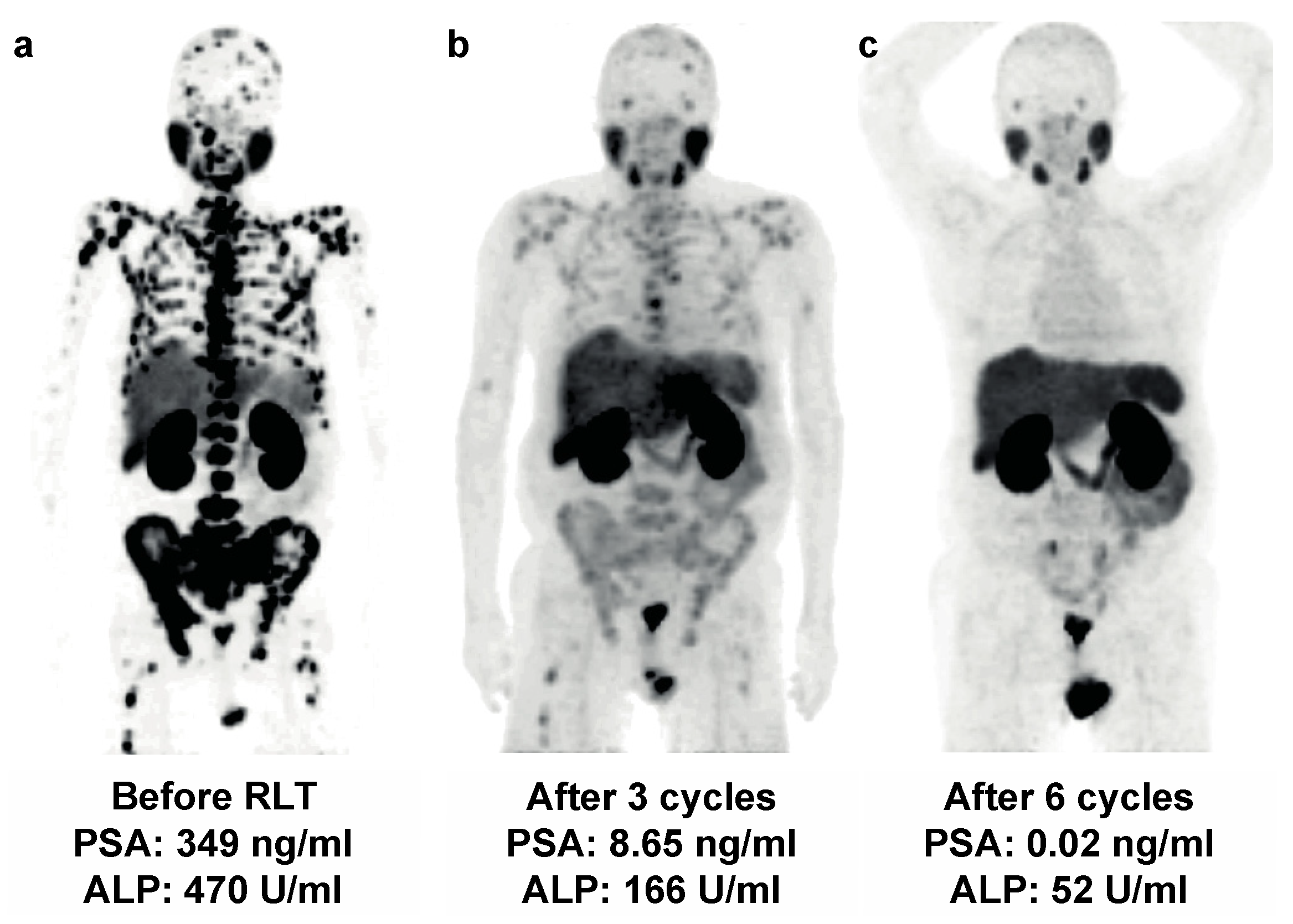 Cancers 13 04017 g003 550