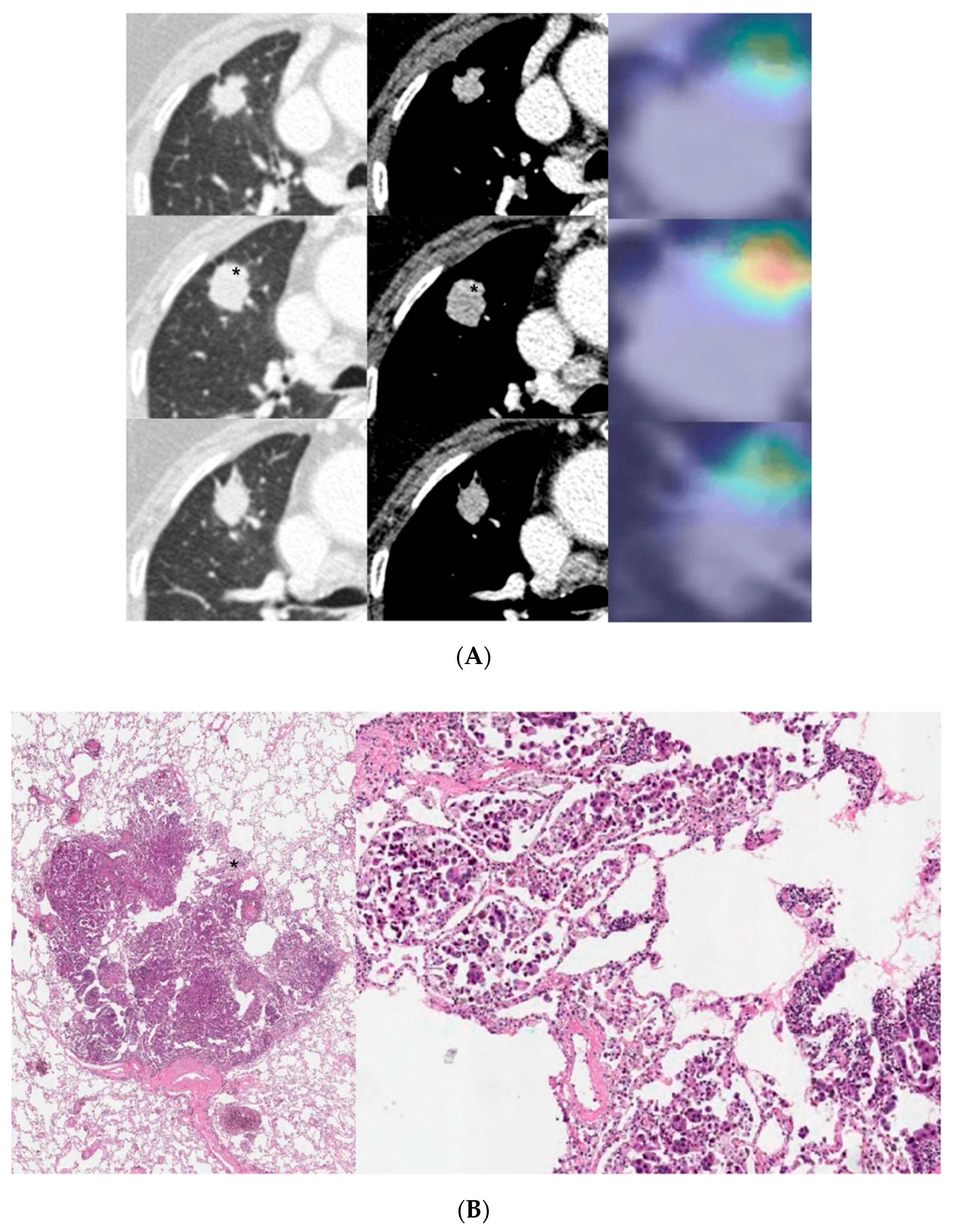 Cancers 13 04077 g005