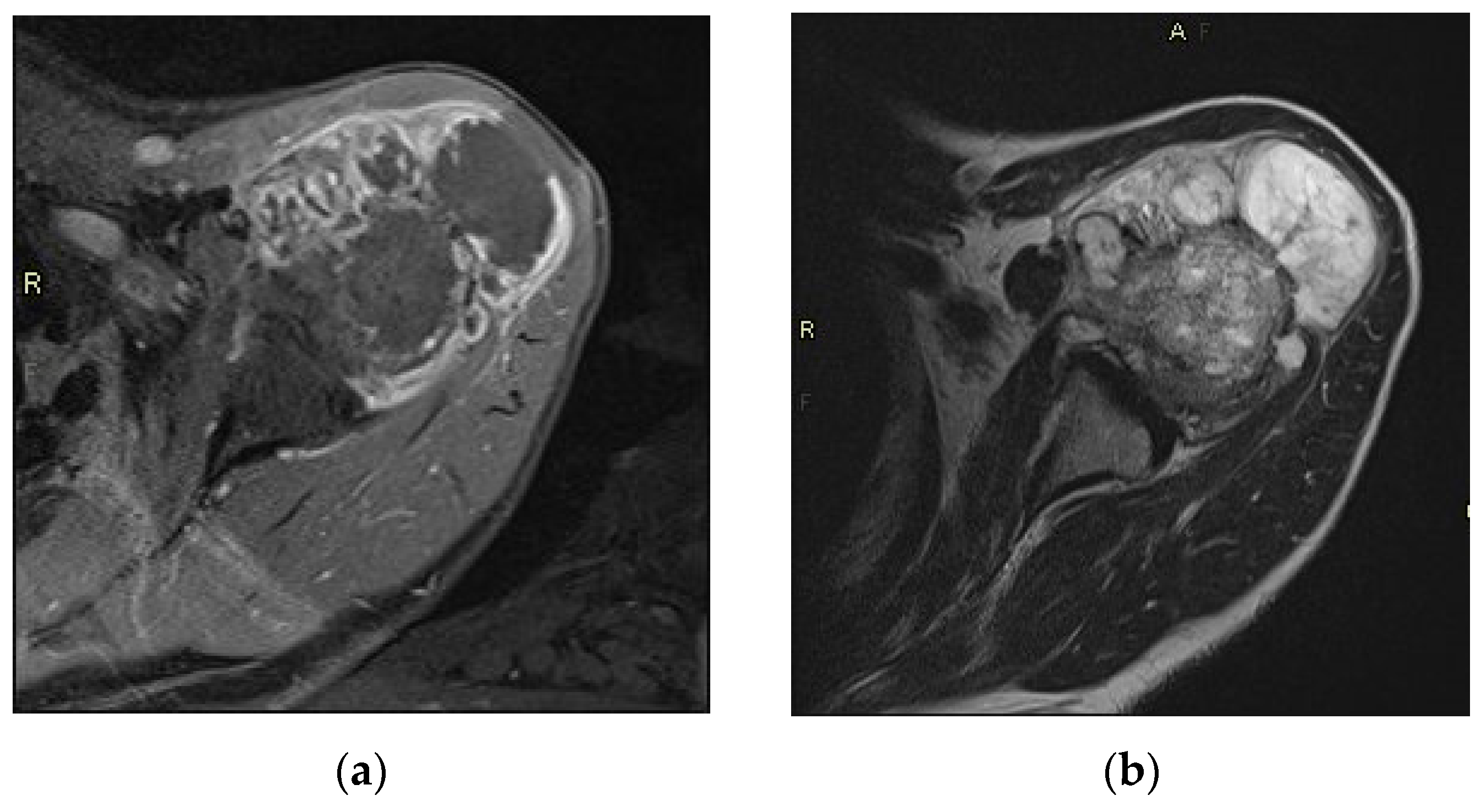 Cancers 13 04093 g002 550