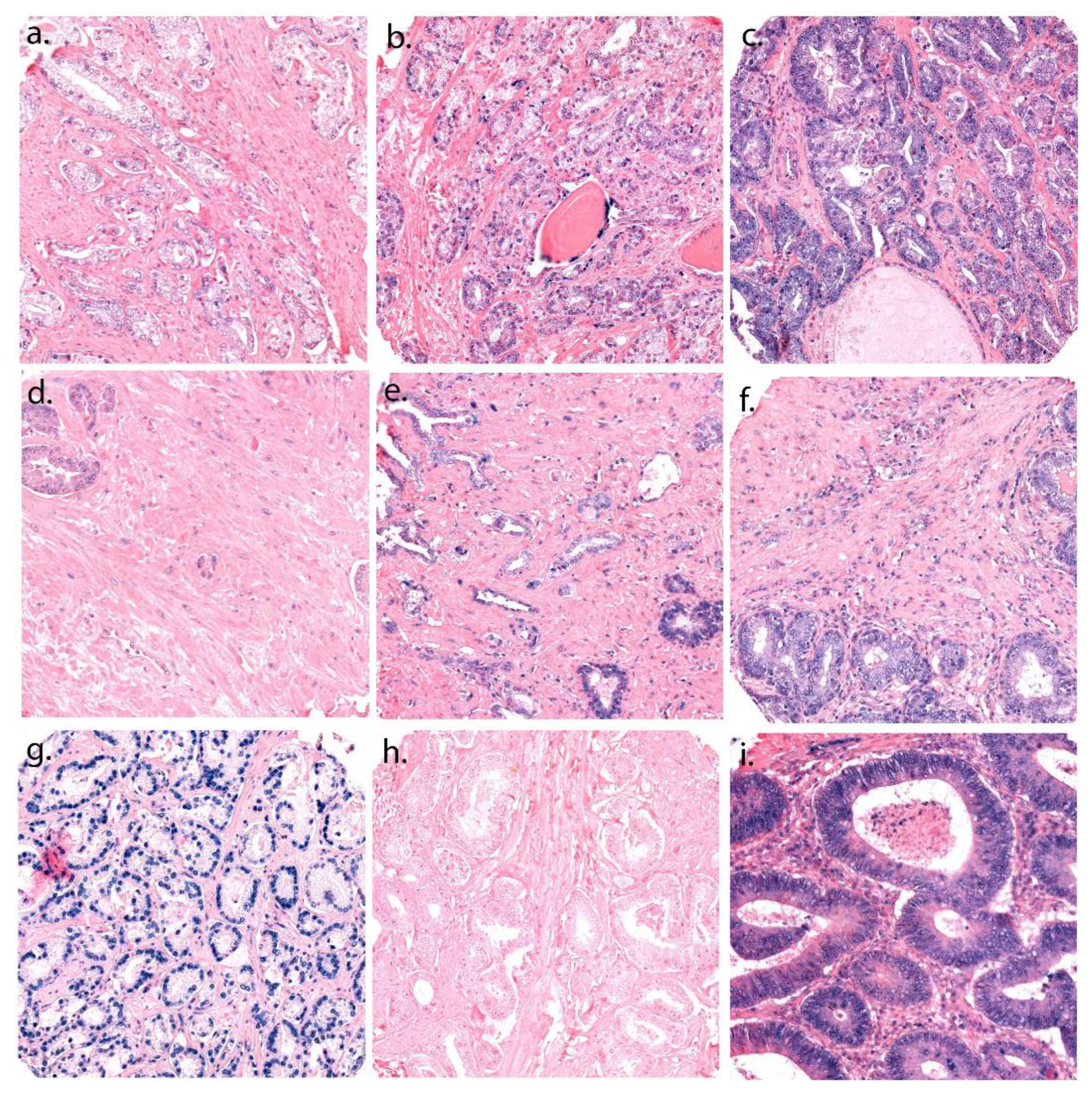 Cancers 13 04096 g001