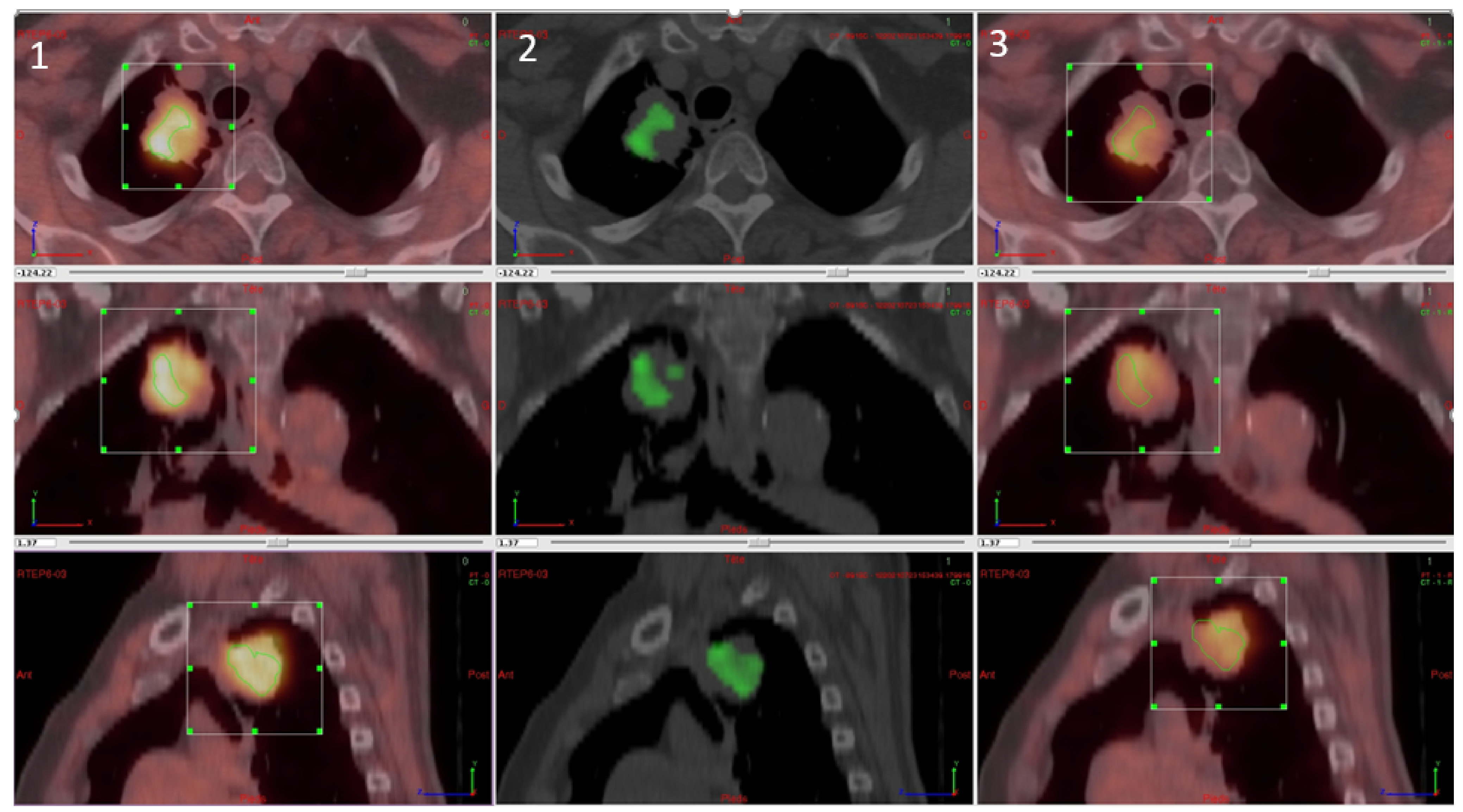 Cancers 13 04101 g004