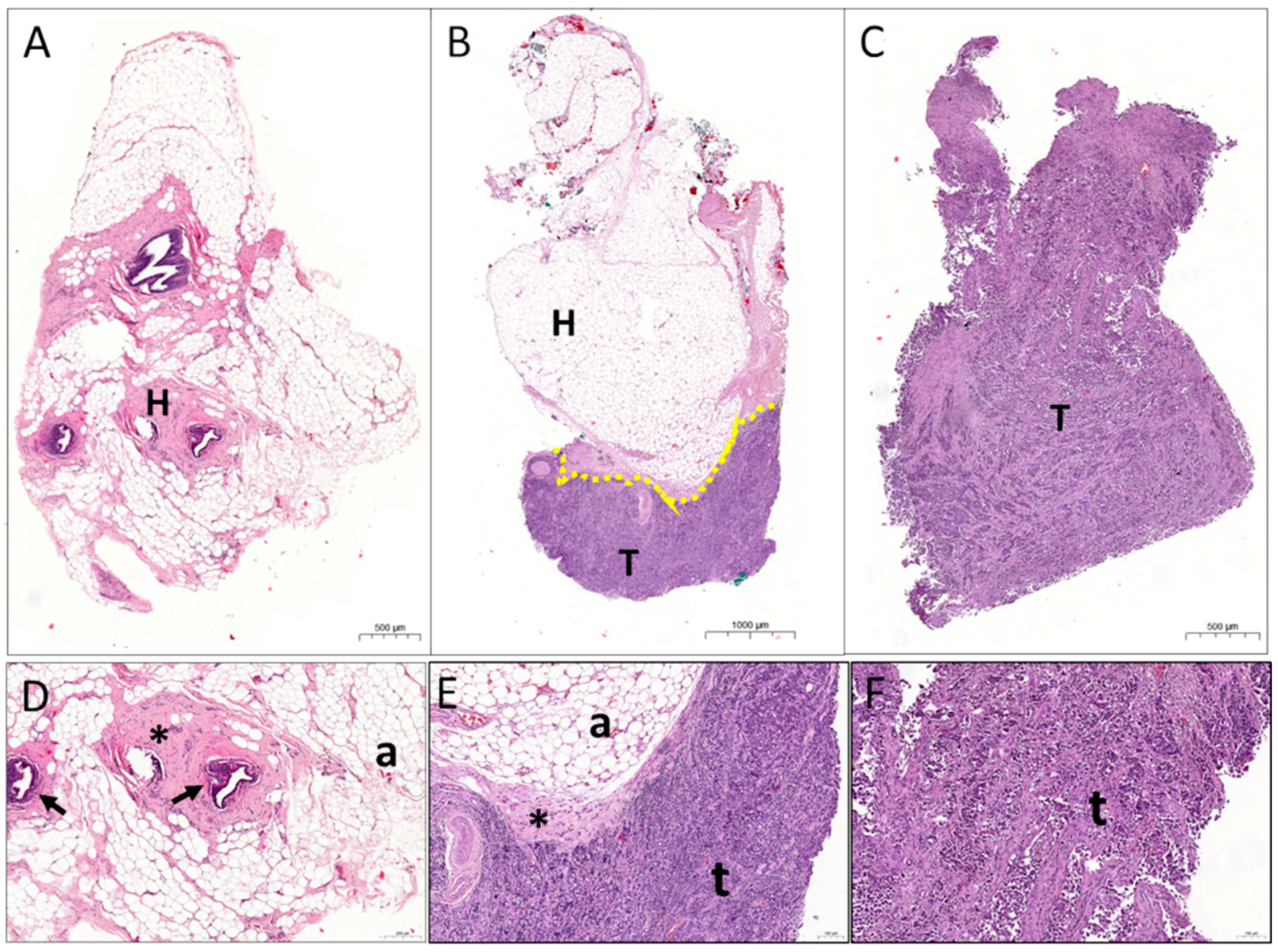 Cancers 13 04141 g001