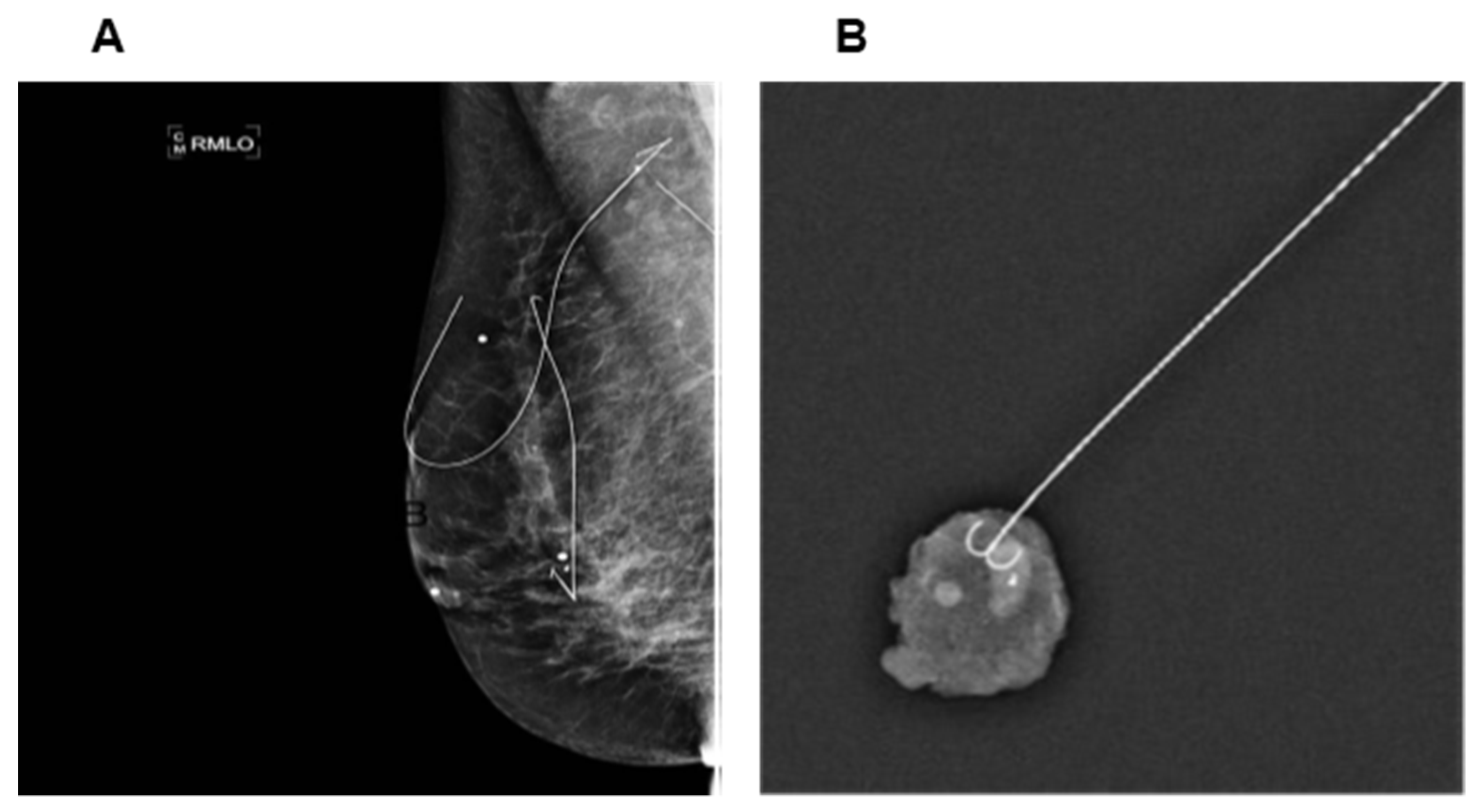 Cancers Free FullText Options to Determine Pathological Response