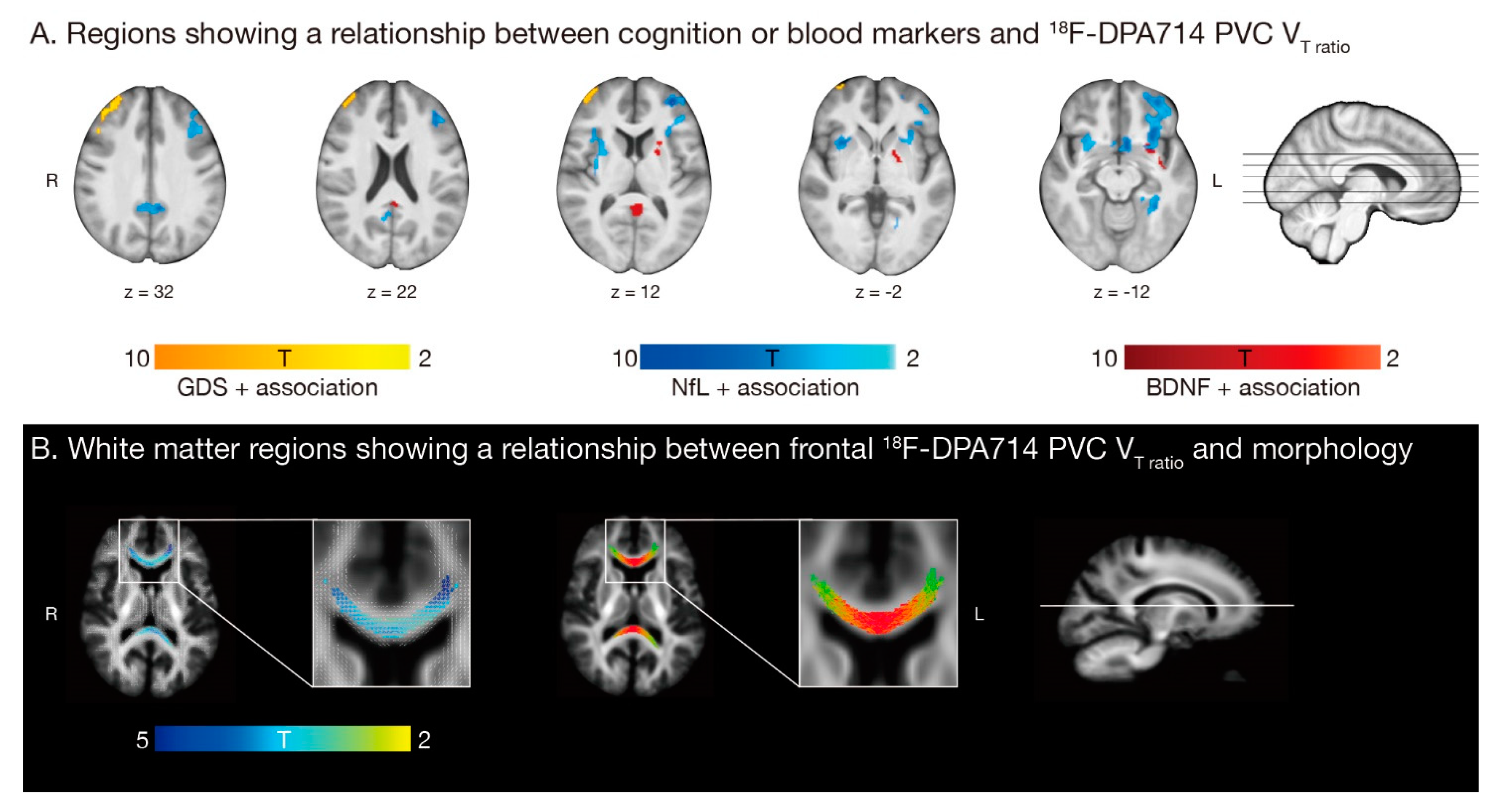 Cancers 13 04198 g004