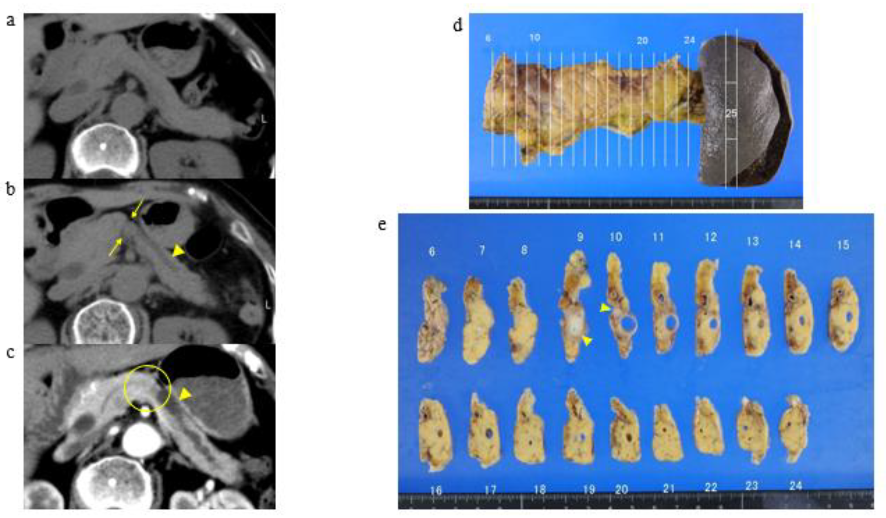 Cancers 13 04222 g003 Cancers 13 04222 g003