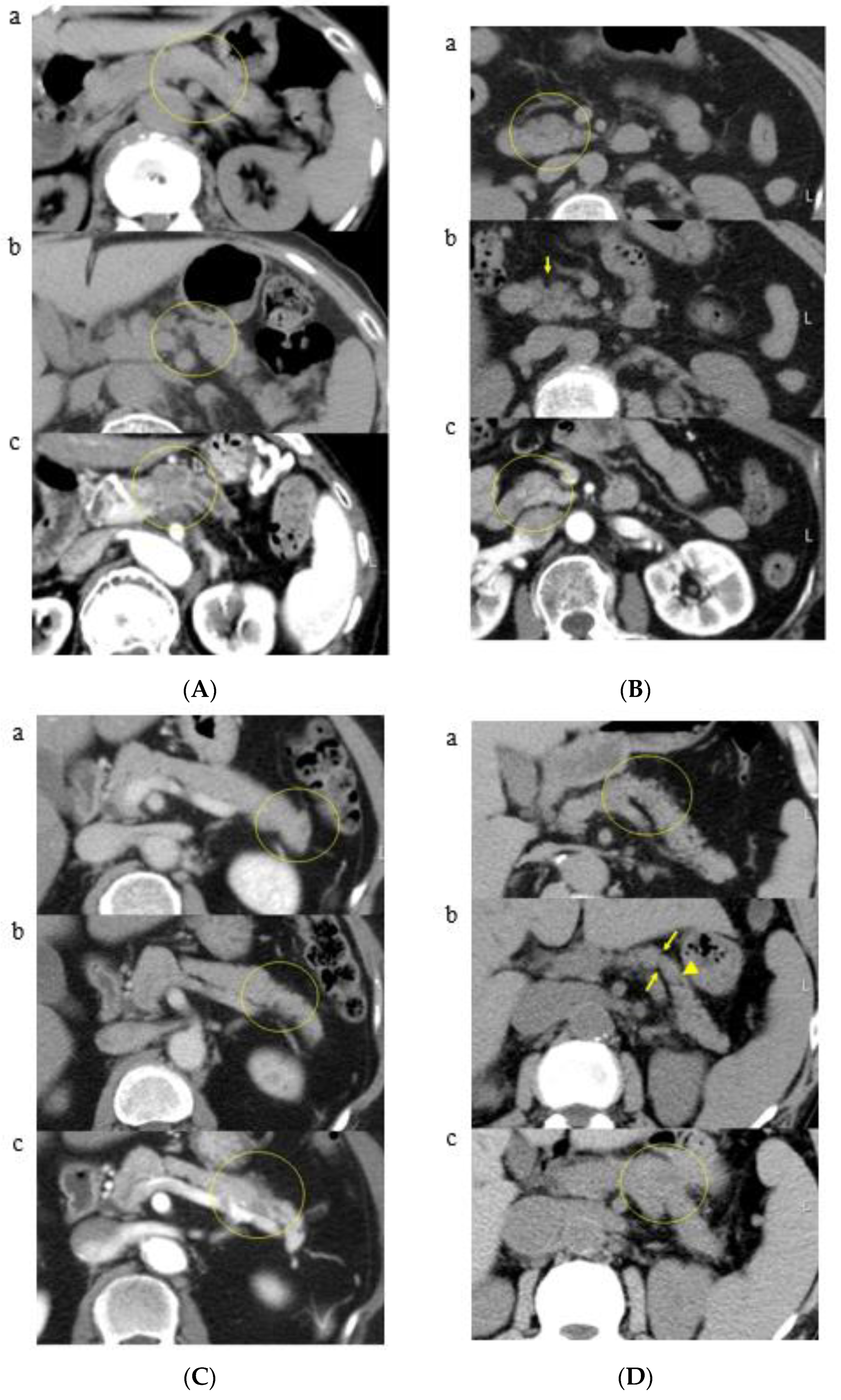 Cancers 13 04222 g004 Cancers 13 04222 g004