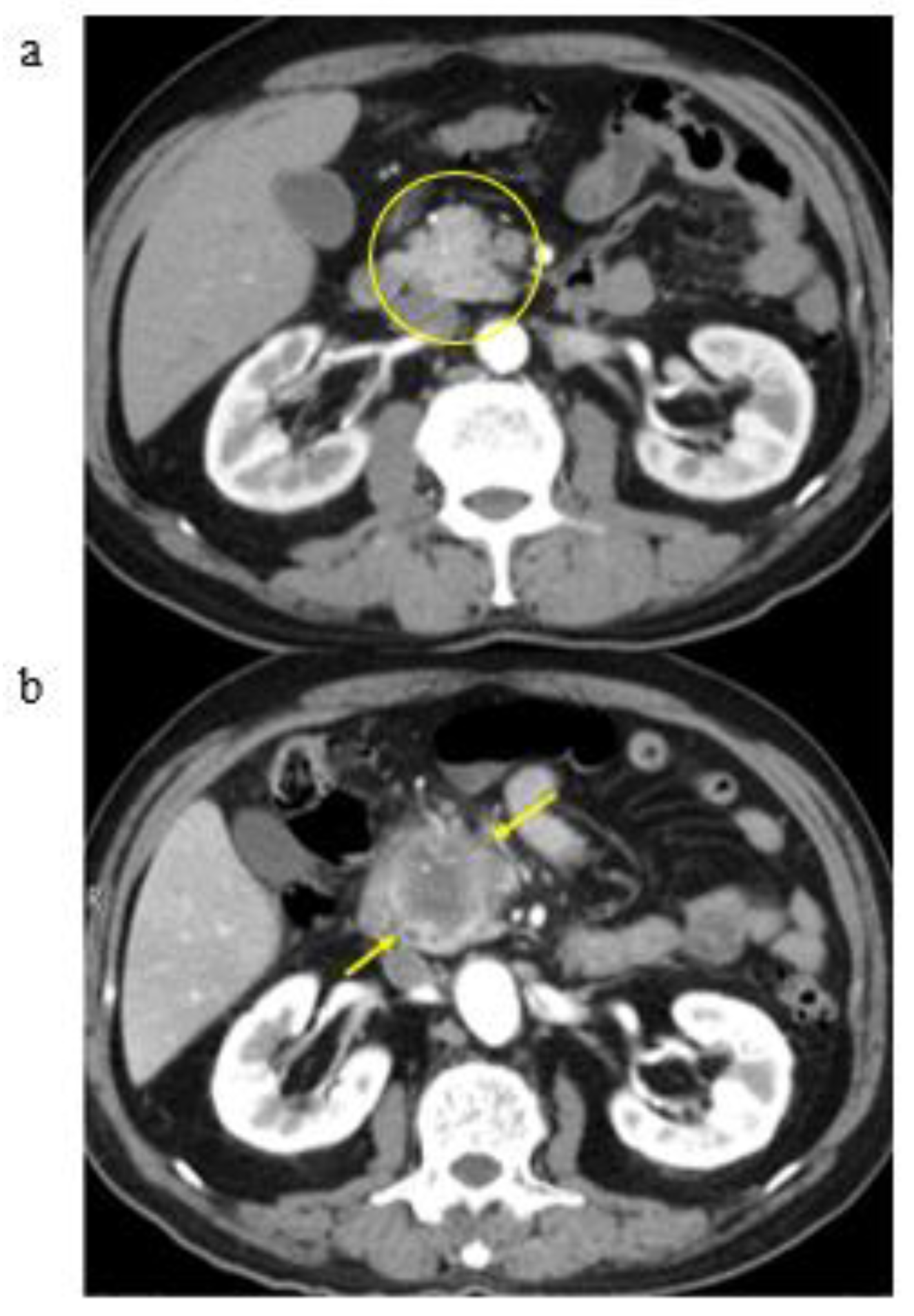 Cancers 13 04222 g006 Cancers 13 04222 g006