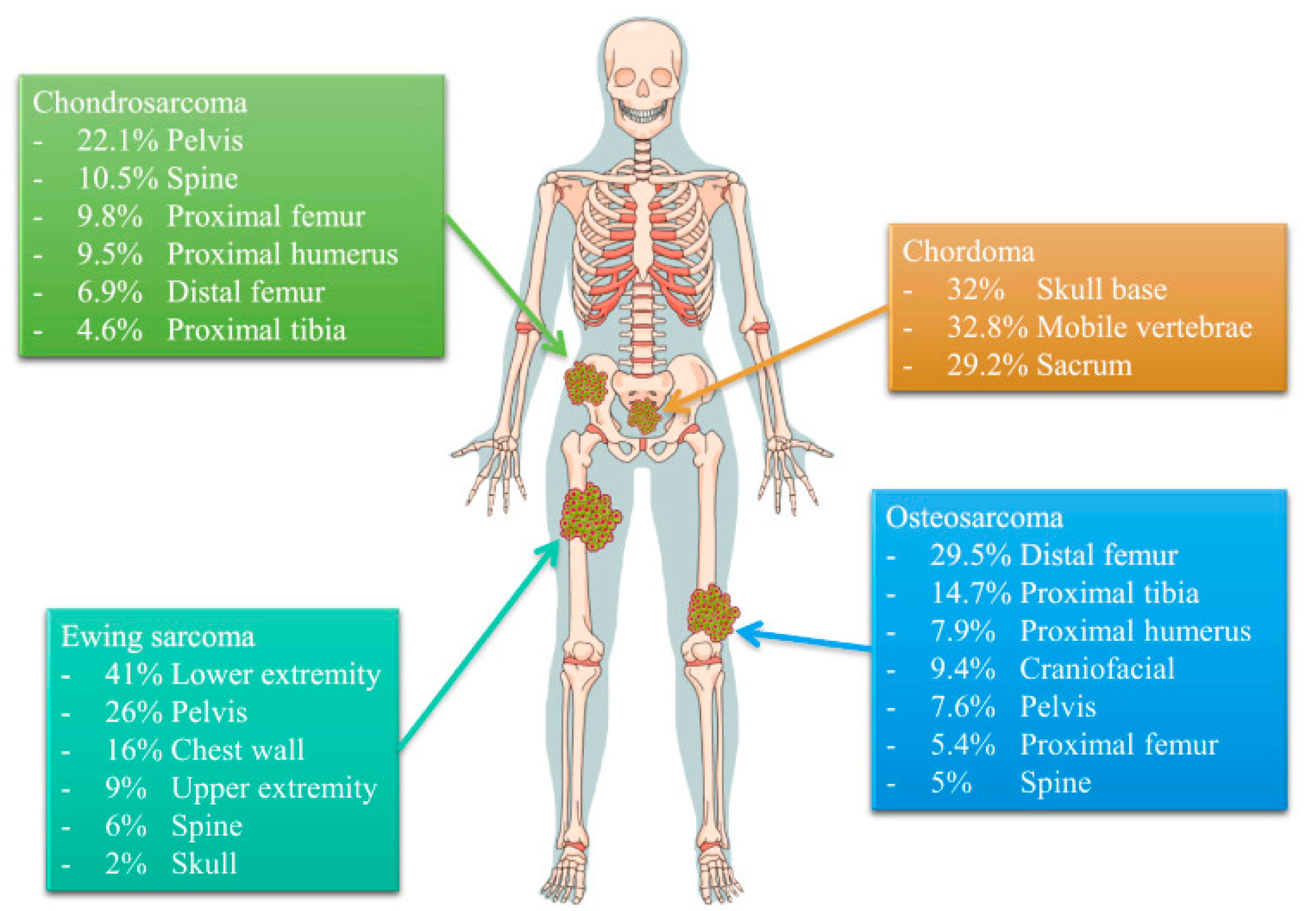 Bone cancer in the hip: Types, symptoms, and treatment