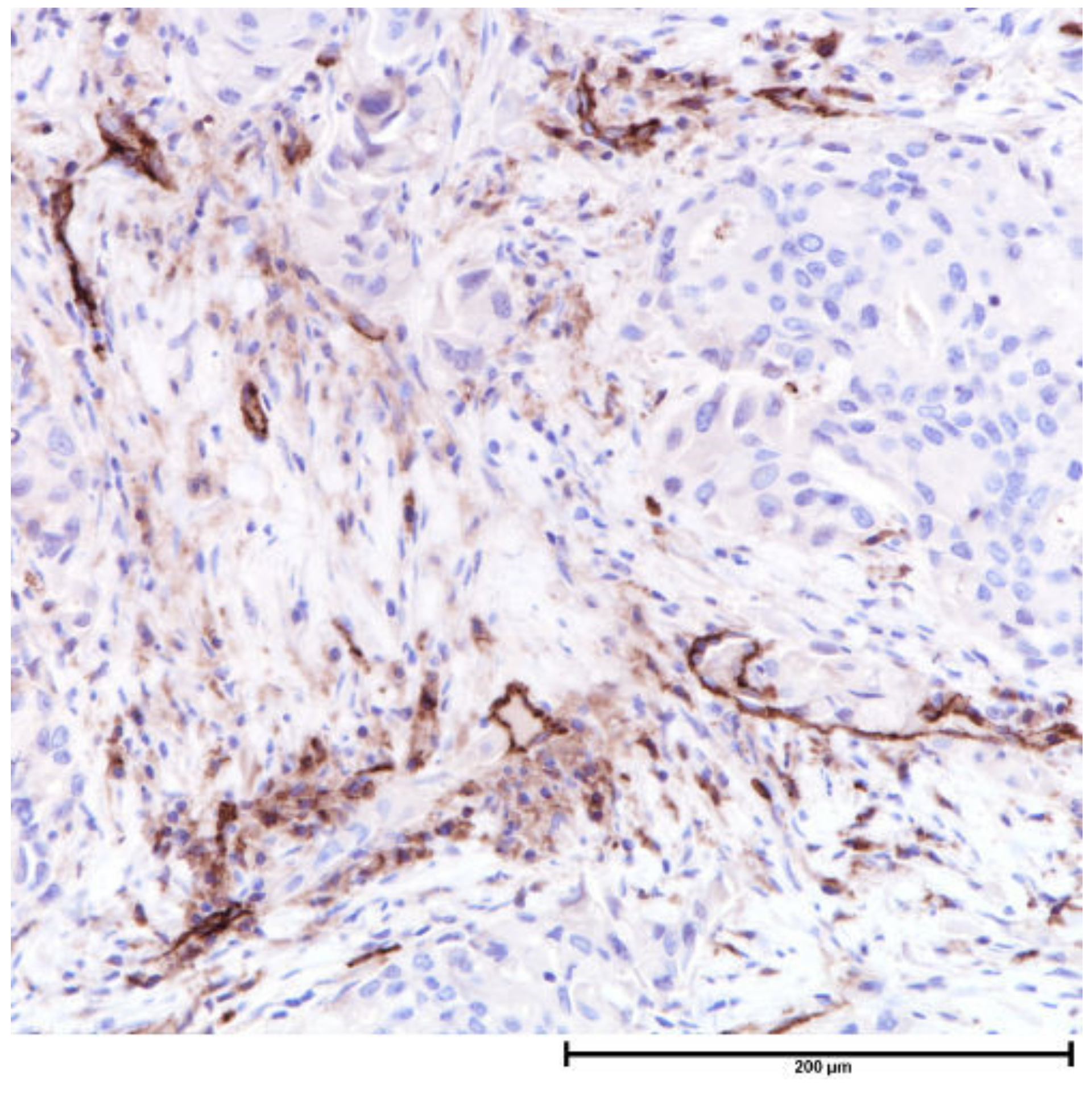 Cancers 13 04233 g006