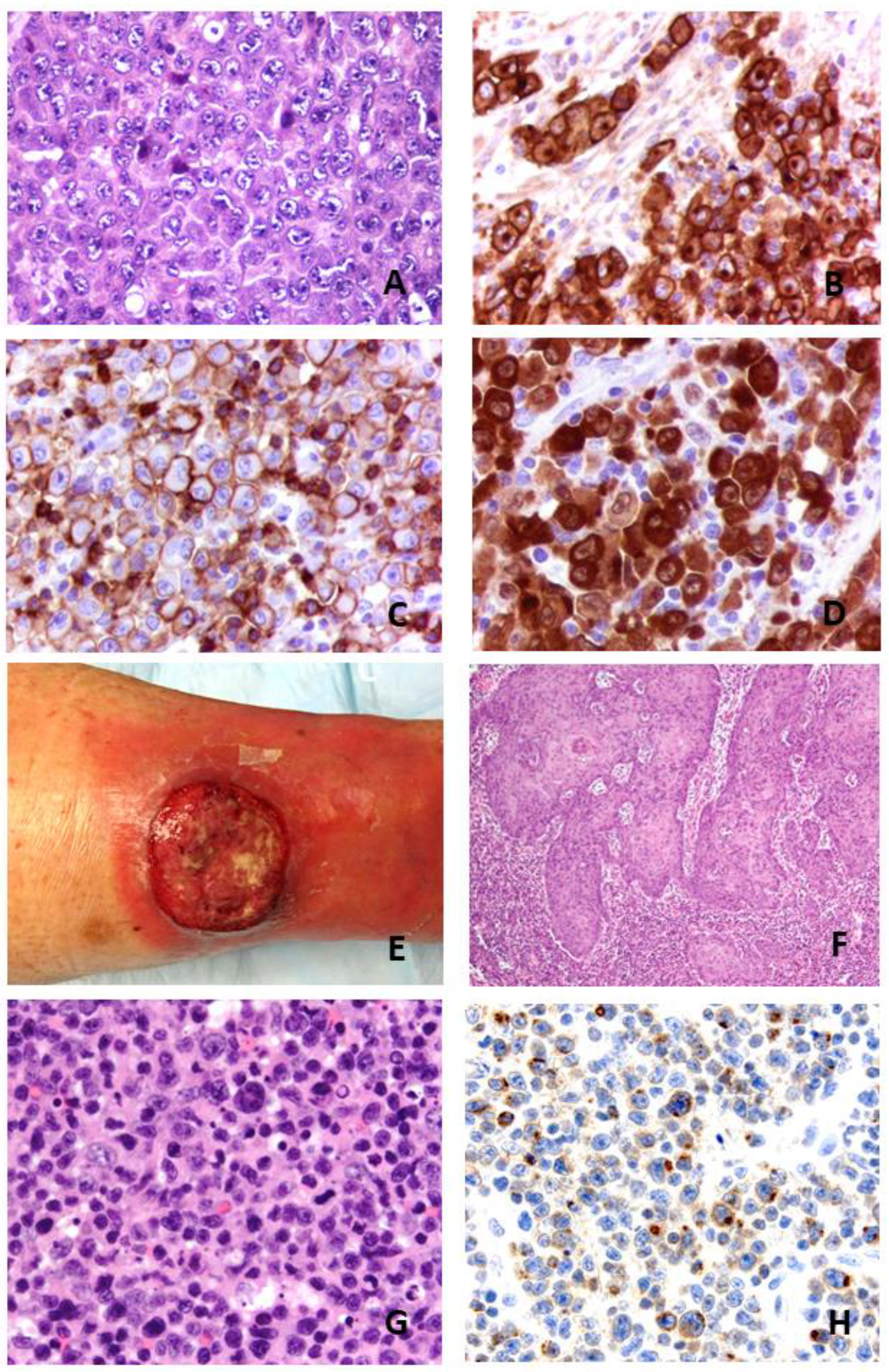 Cancers 13 04256 g001