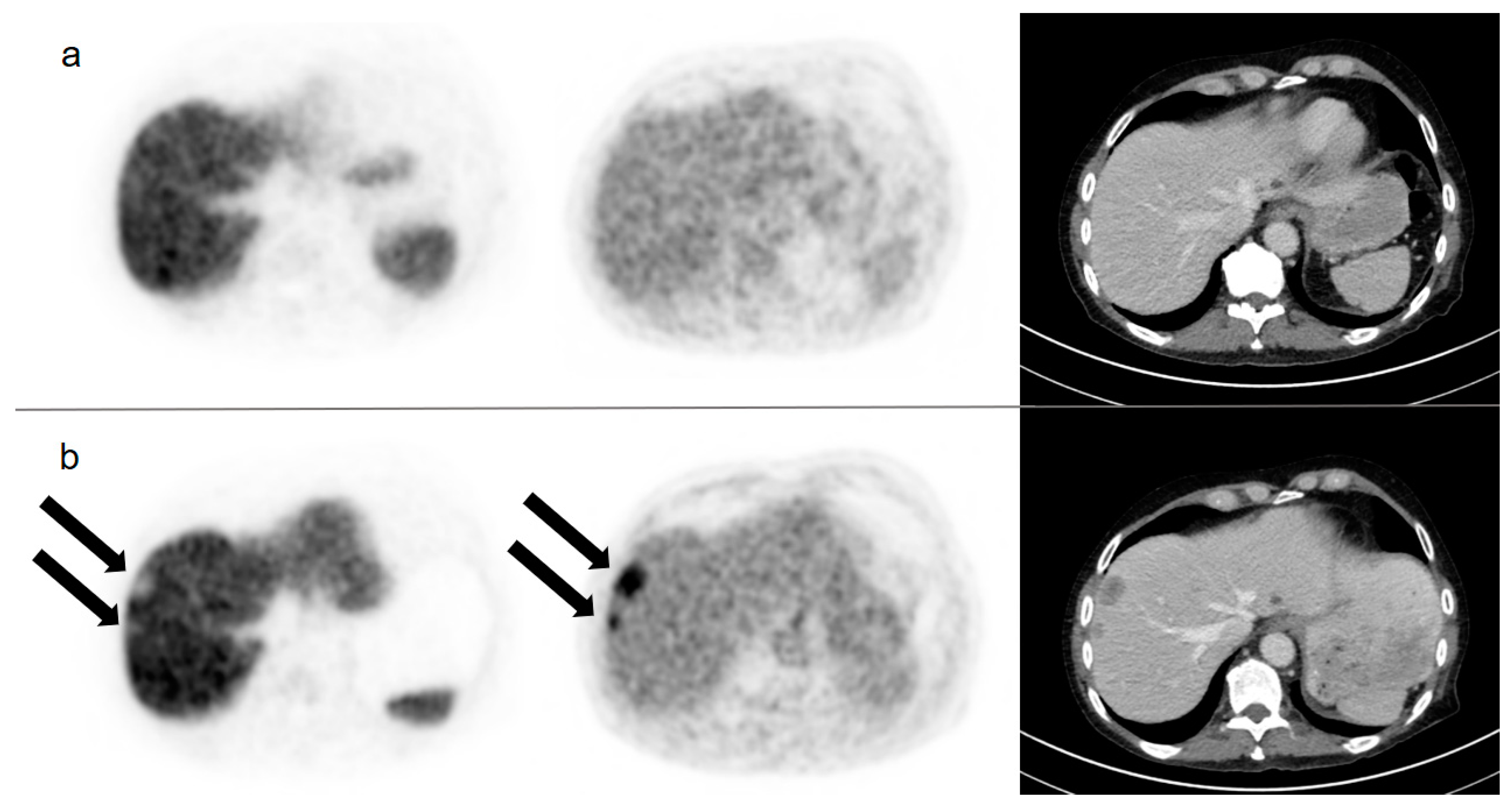 Cancers 13 04270 g003 550