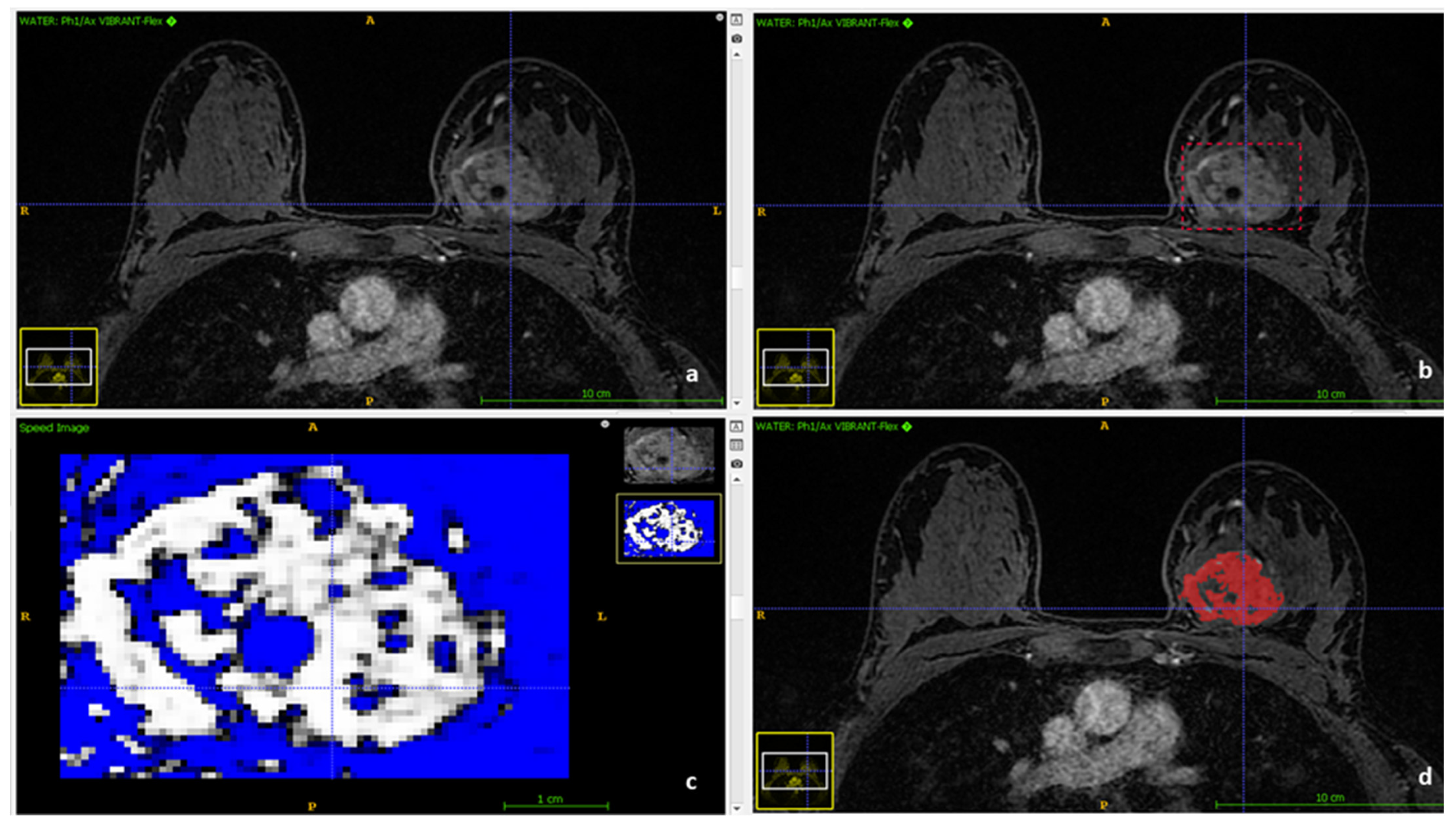 Cancers 13 04271 g002