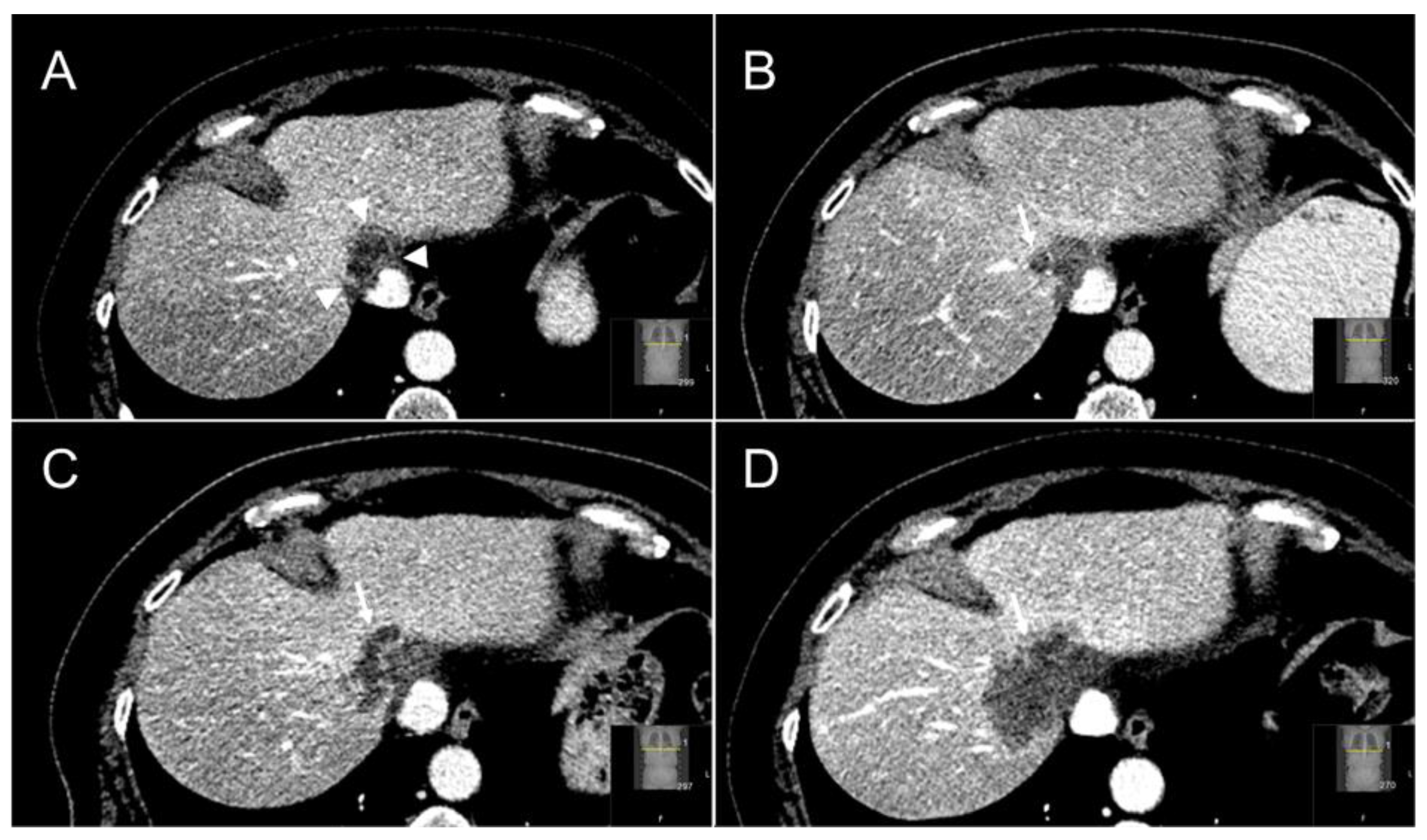 Cancers 13 04303 g005