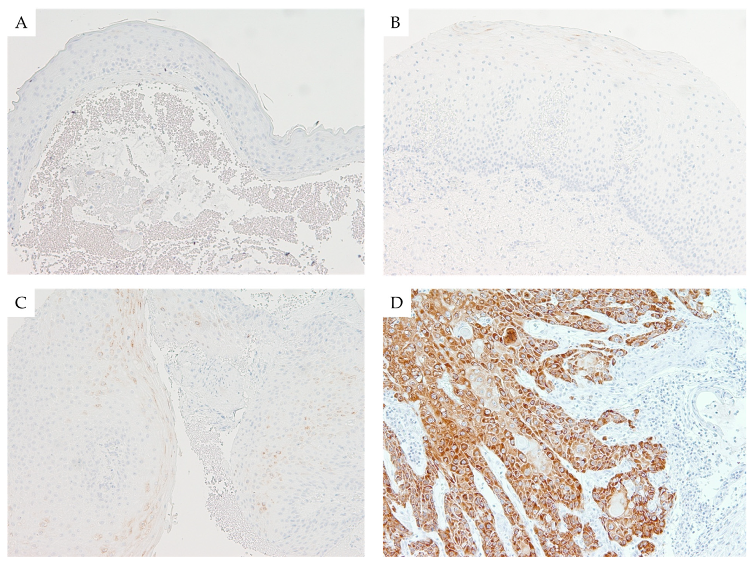 Cancers 13 04306 g002 550