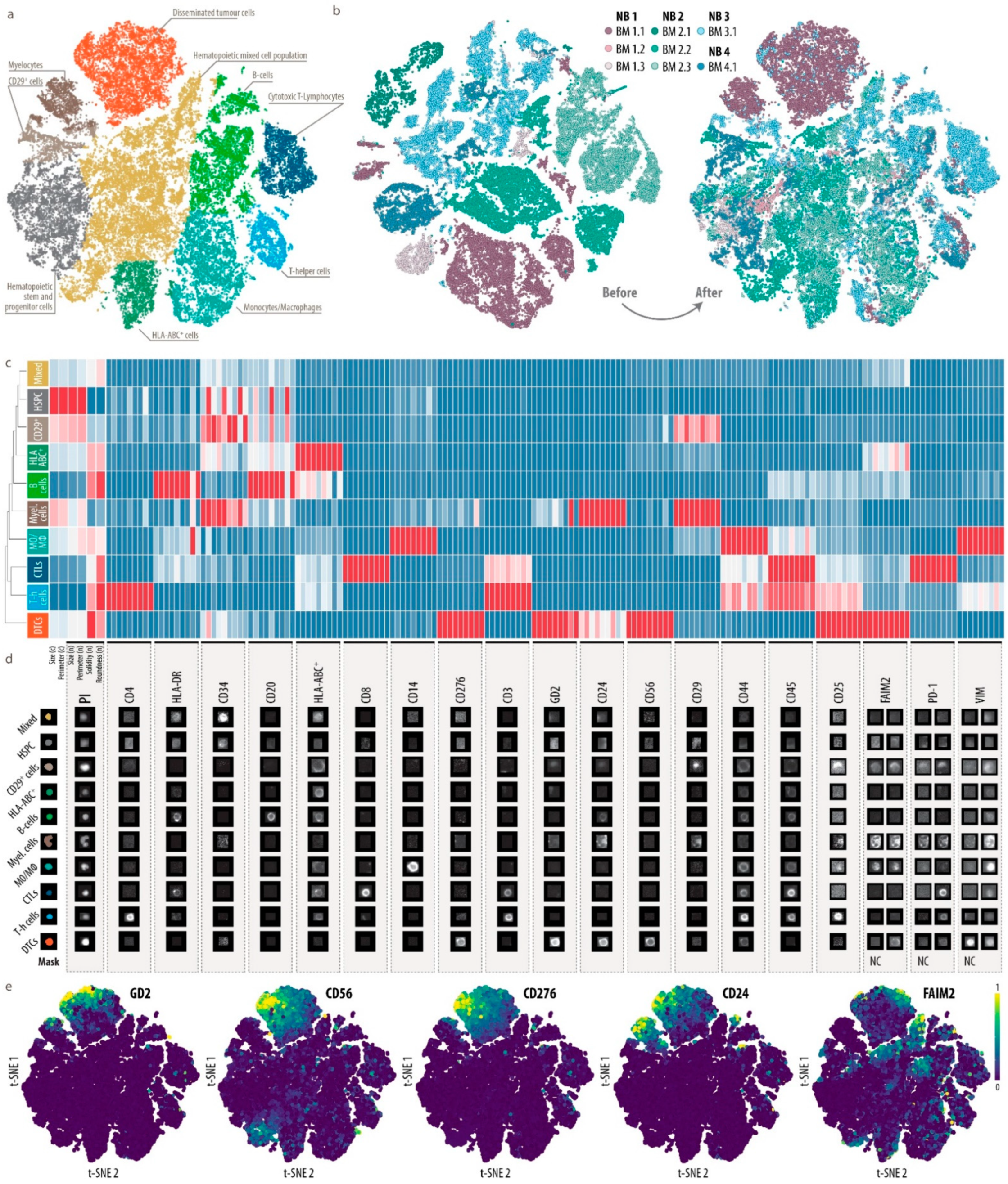 Cancers Free Full-Text Landscape of Bone Marrow Metastasis in Human Neuroblastoma Unraveled by Transcriptomics and Deep Multiplex Imaging