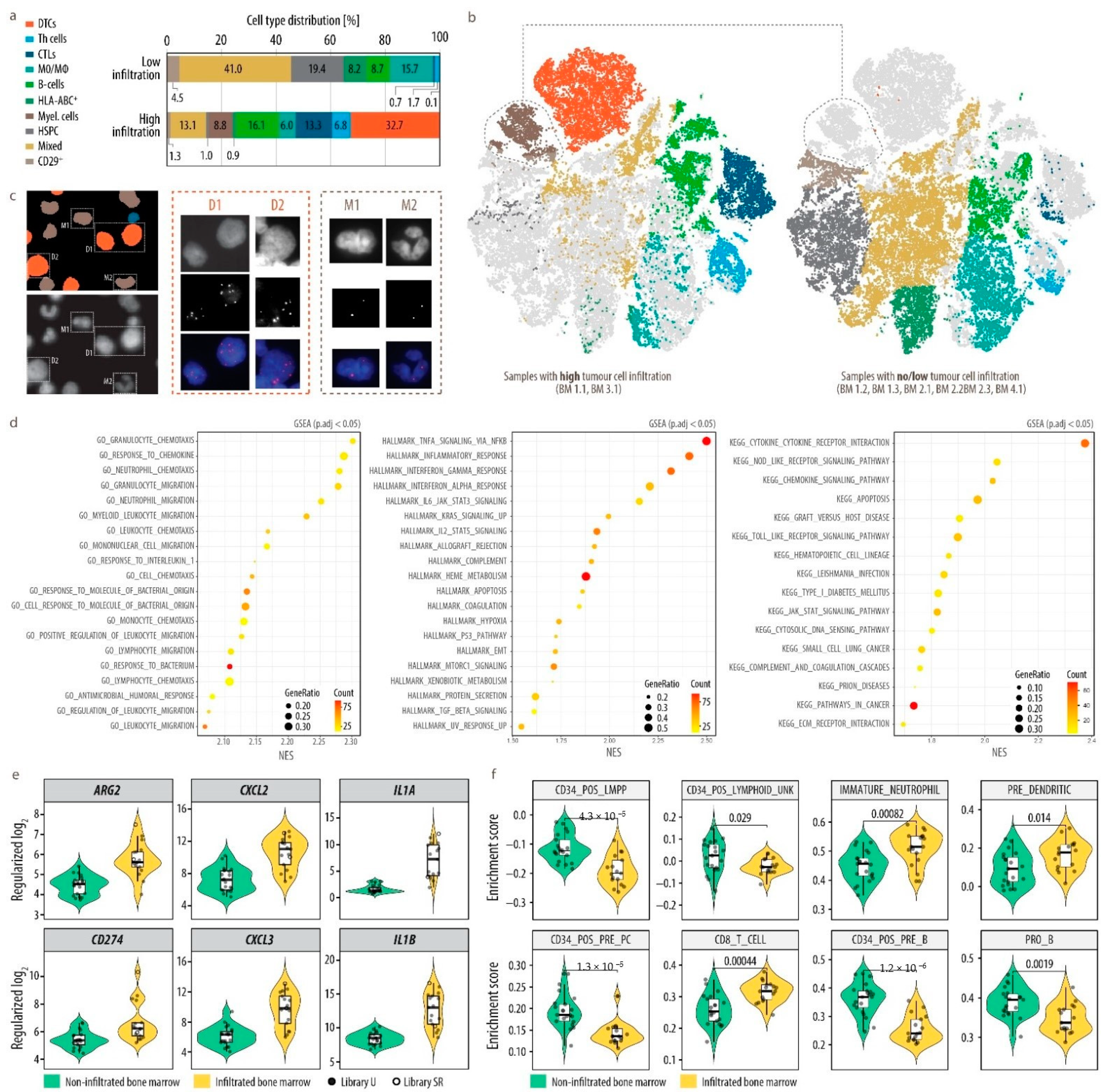 Cancers Free Full-Text Landscape of Bone Marrow Metastasis in Human Neuroblastoma Unraveled by Transcriptomics and Deep Multiplex Imaging photo picture pic